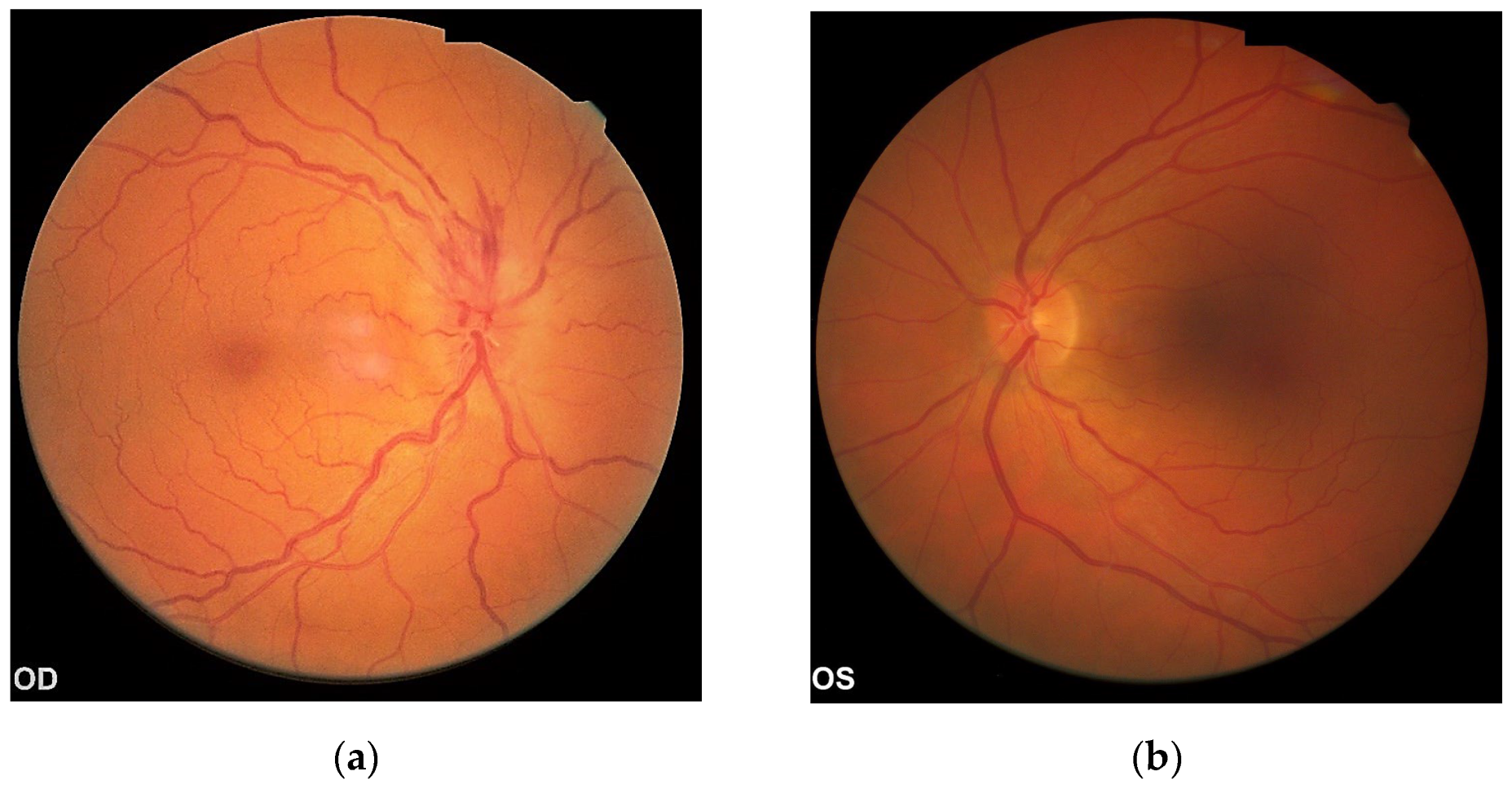 Diagnostics 13 01267 g001