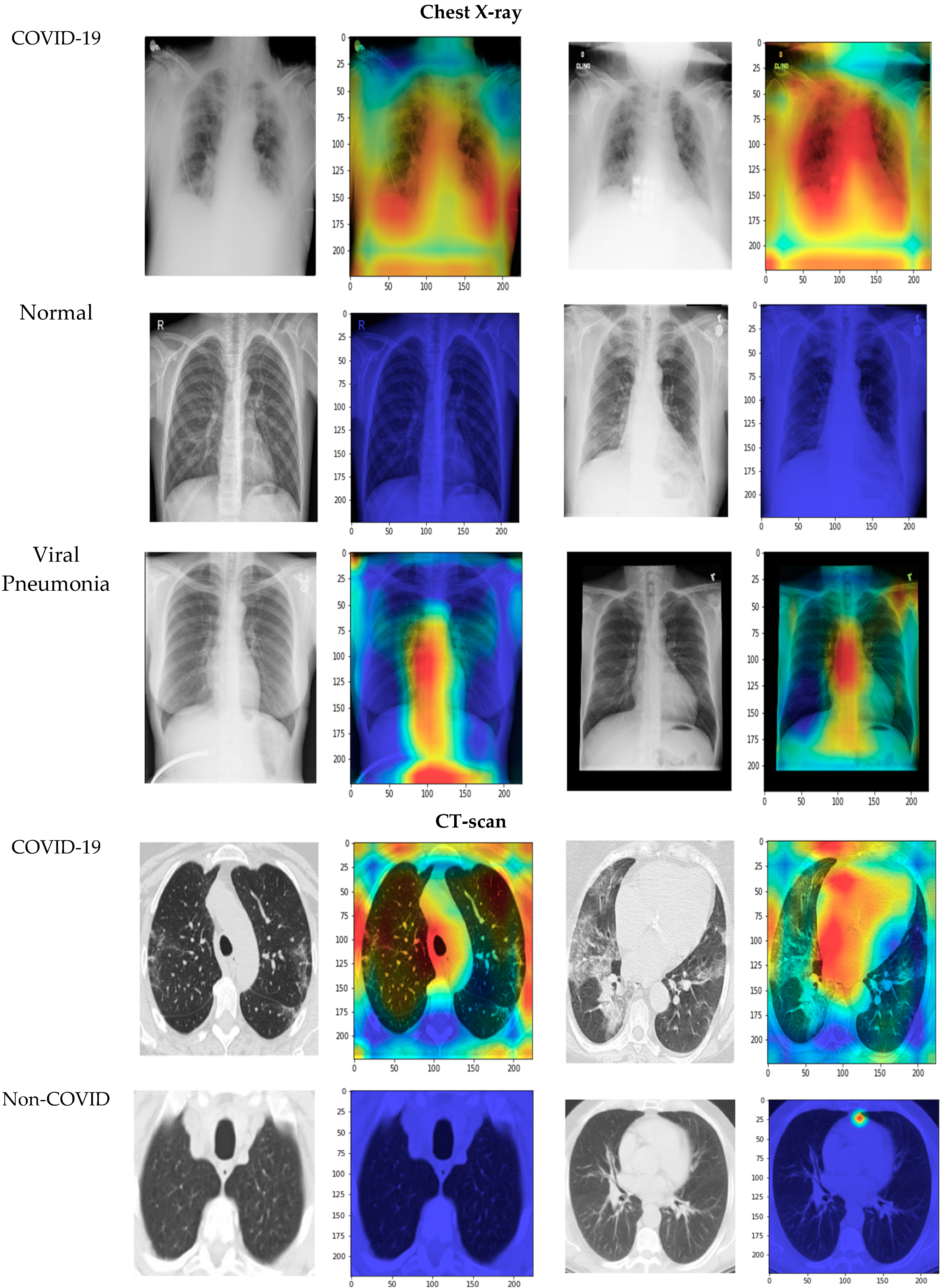 Diagnostics 13 01268 g012