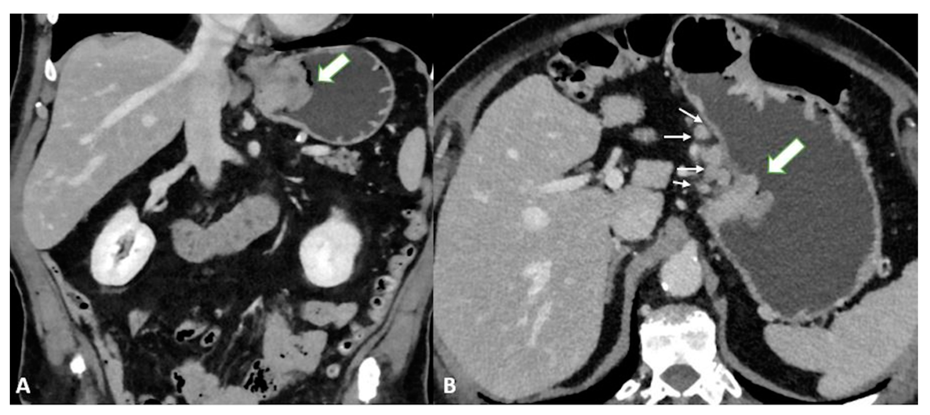 Diagnostics 13 01276 g003 Diagnostics 13 01276 g003