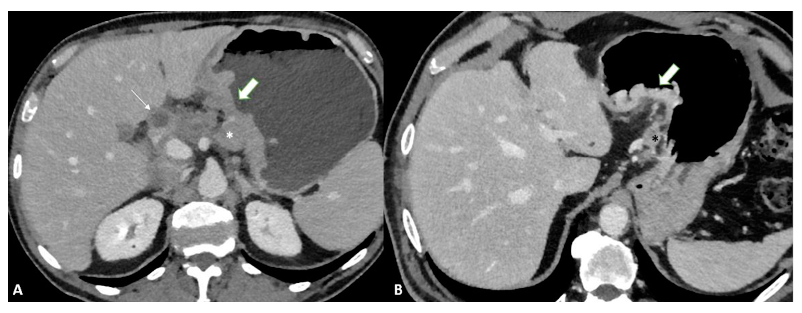 Diagnostics 13 01276 g004 Diagnostics 13 01276 g004