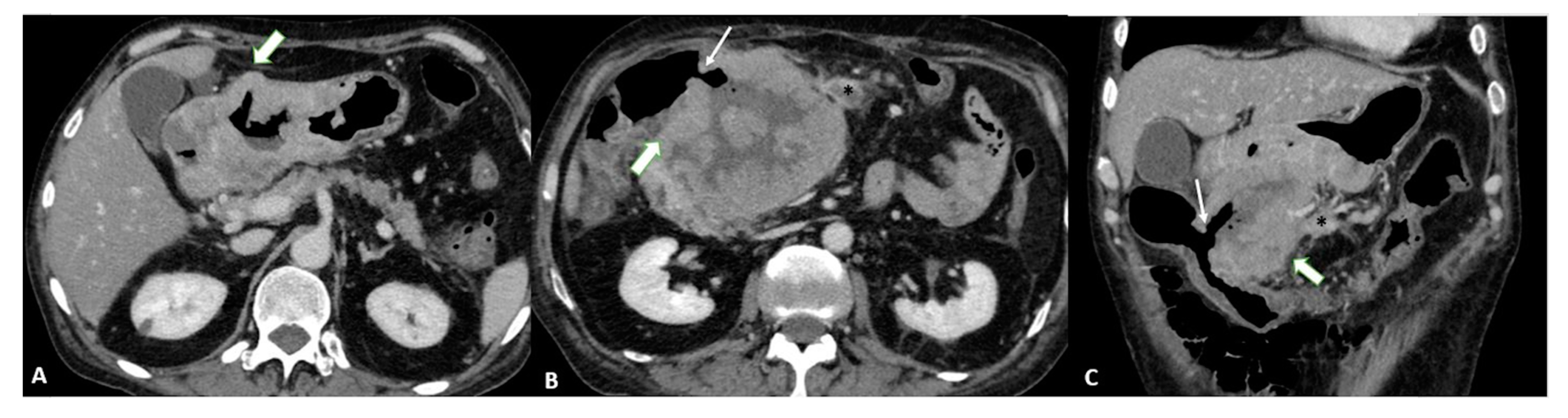 Diagnostics 13 01276 g005 Diagnostics 13 01276 g005