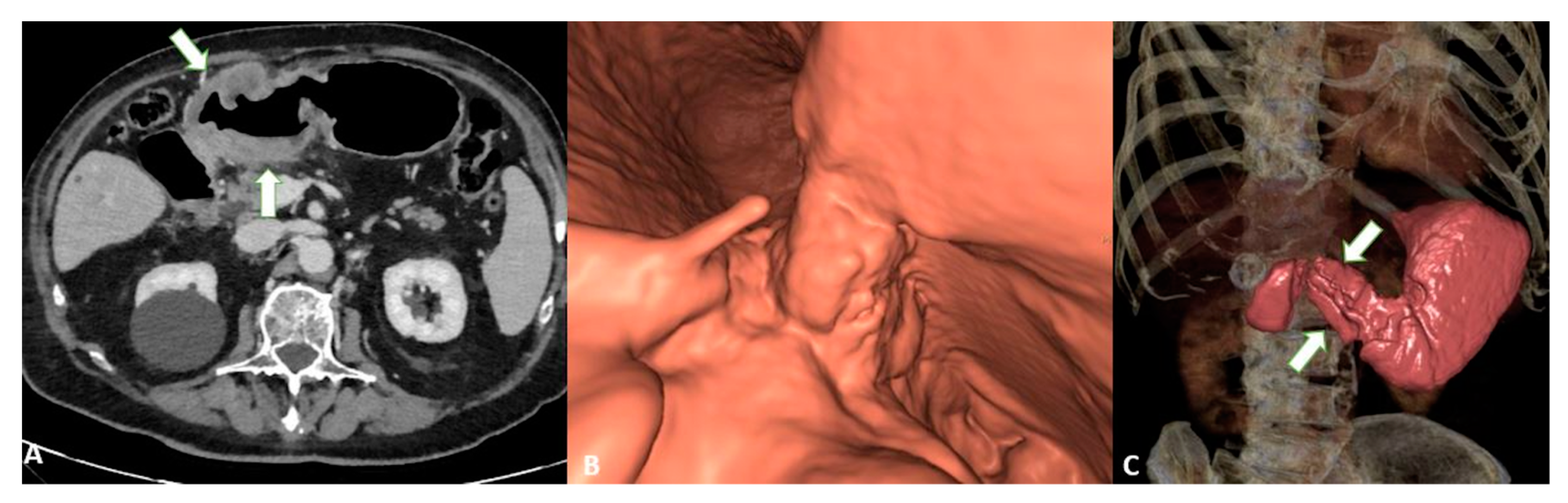 Diagnostics 13 01276 g006 Diagnostics 13 01276 g006