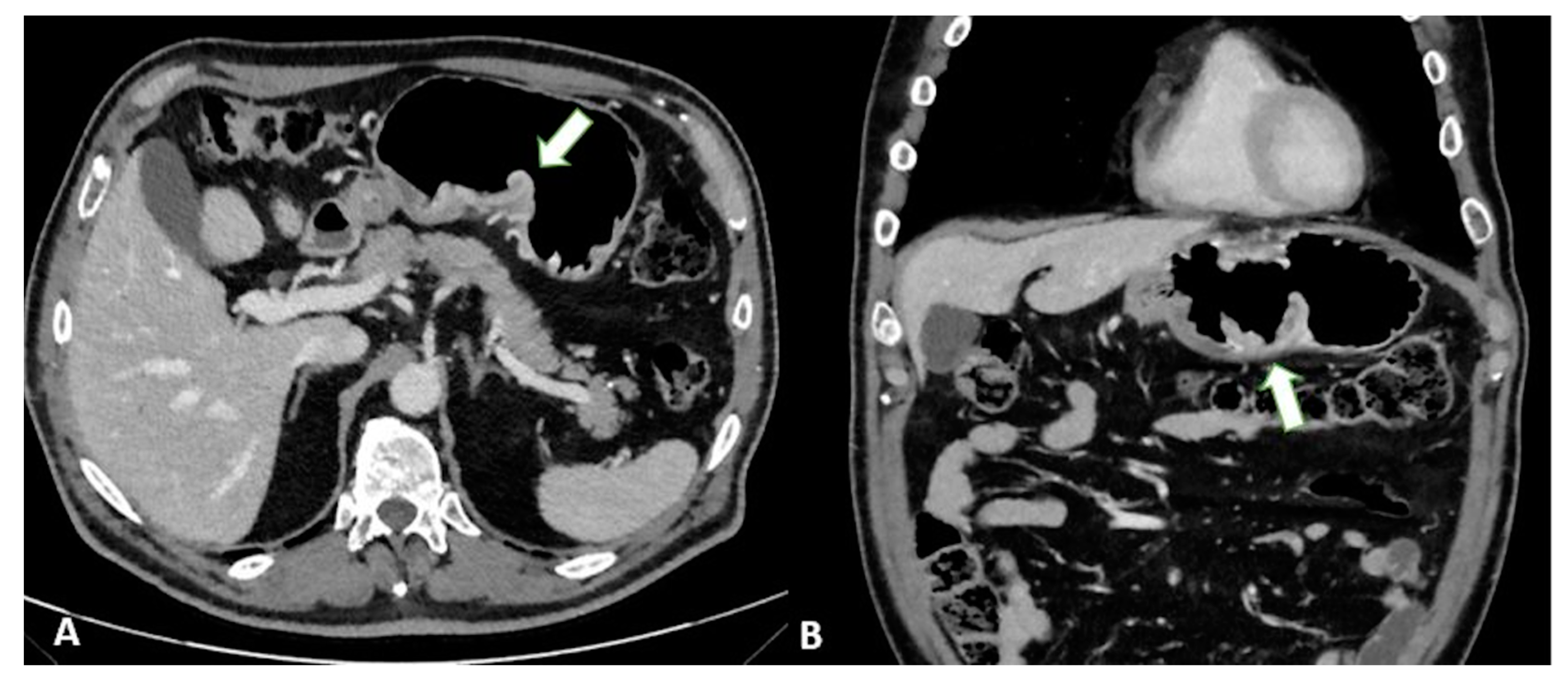 Diagnostics 13 01276 g007 Diagnostics 13 01276 g007