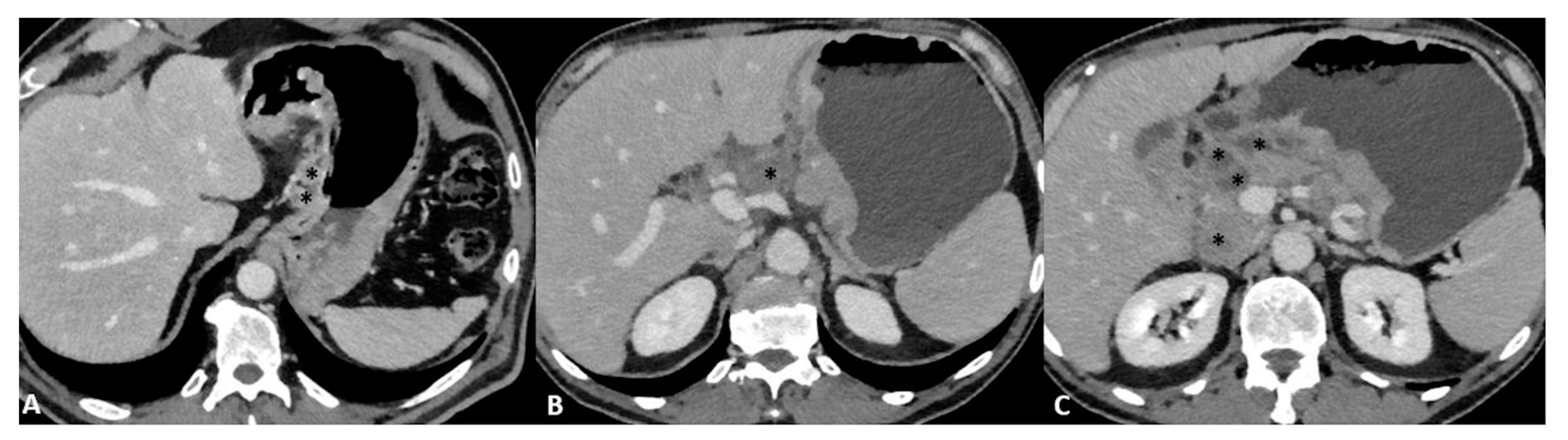 Diagnostics 13 01276 g008 Diagnostics 13 01276 g008