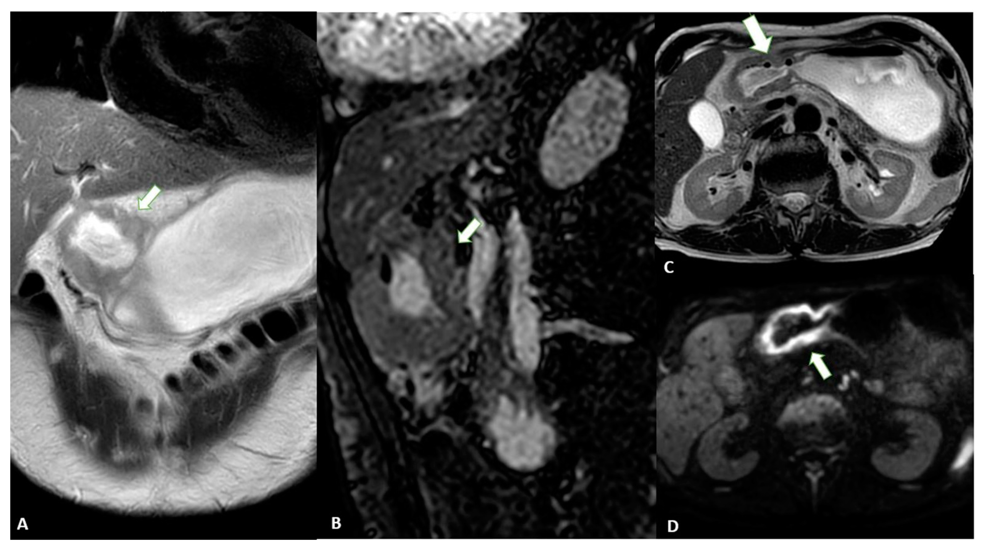 Diagnostics 13 01276 g009 Diagnostics 13 01276 g009