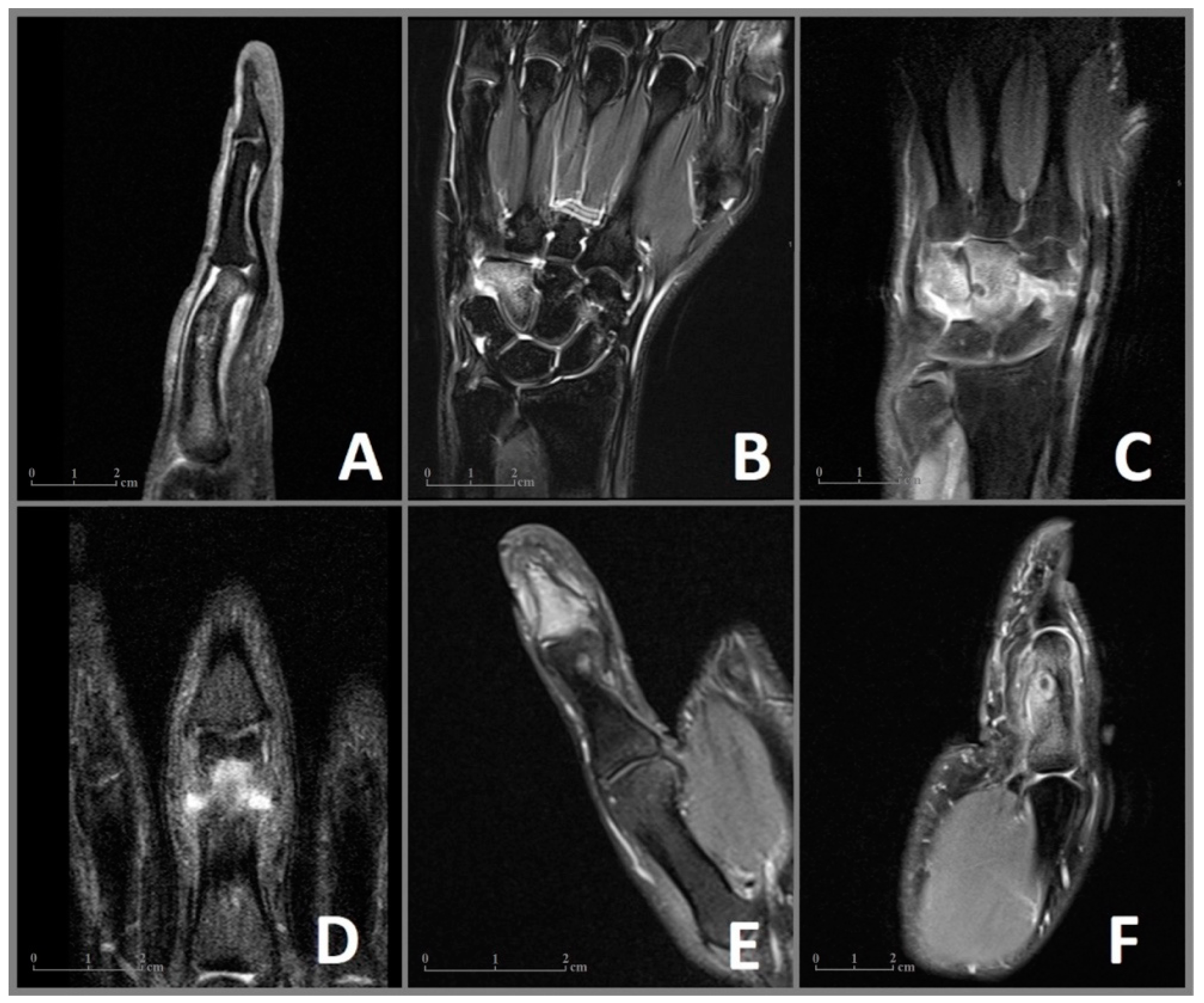 Diagnostics 13 01279 g001