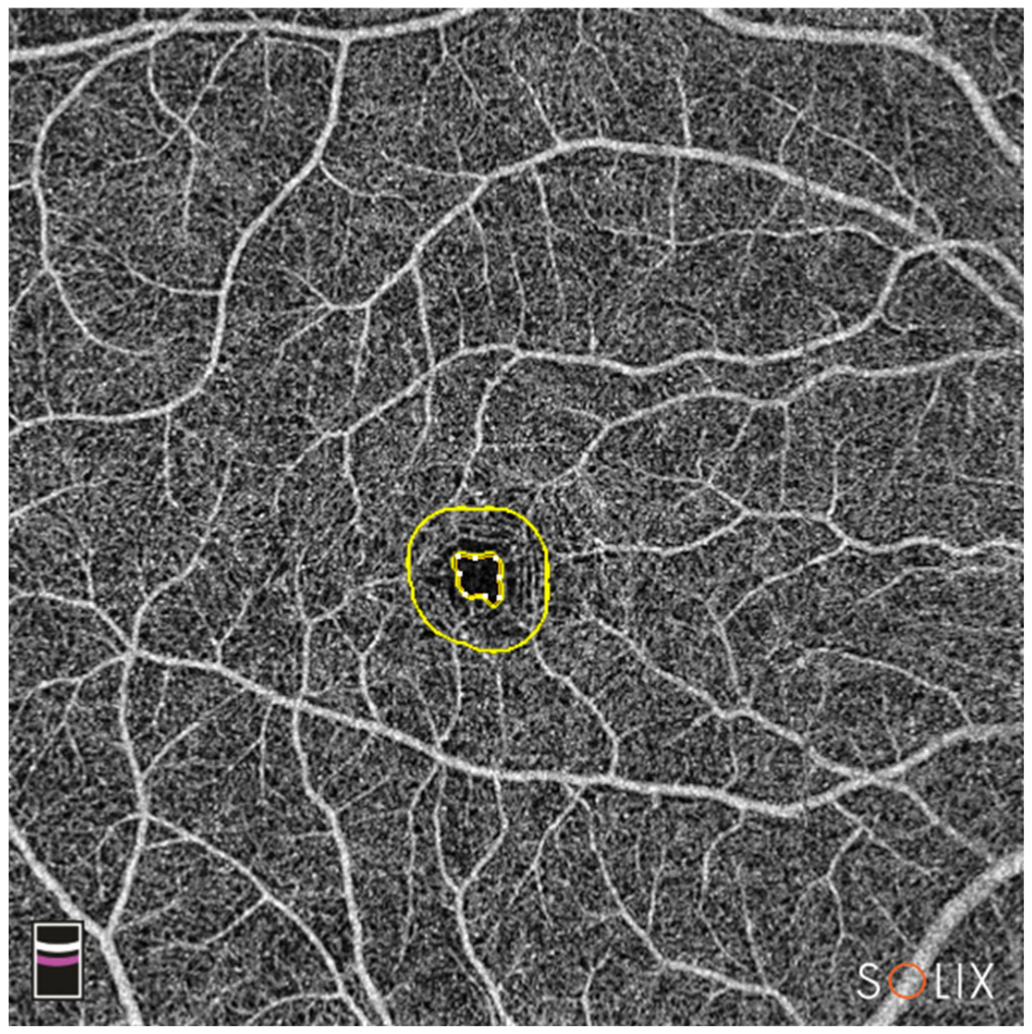 Diagnostics 13 01283 g004
