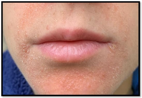 Diagnostics 13 01286 g001 550