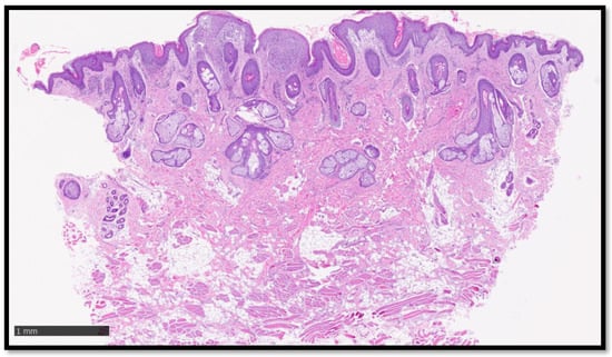 Diagnostics 13 01286 g002 550