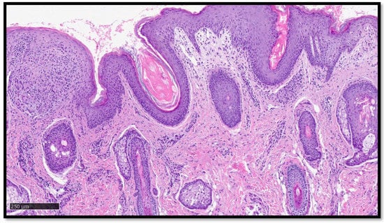 Diagnostics 13 01286 g004 550