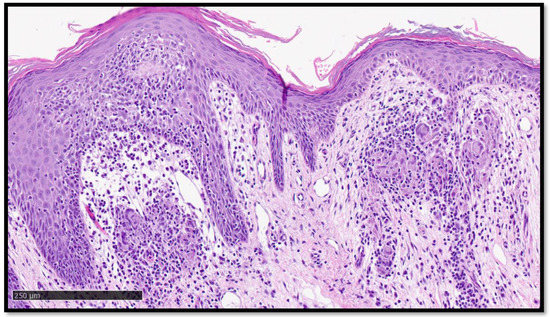 Diagnostics 13 01286 g005 550