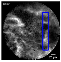Diagnostics 13 01289 i003