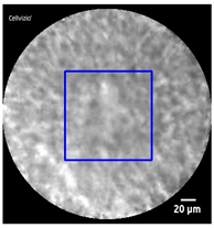 Diagnostics 13 01289 i006
