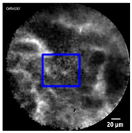 Diagnostics 13 01289 i010