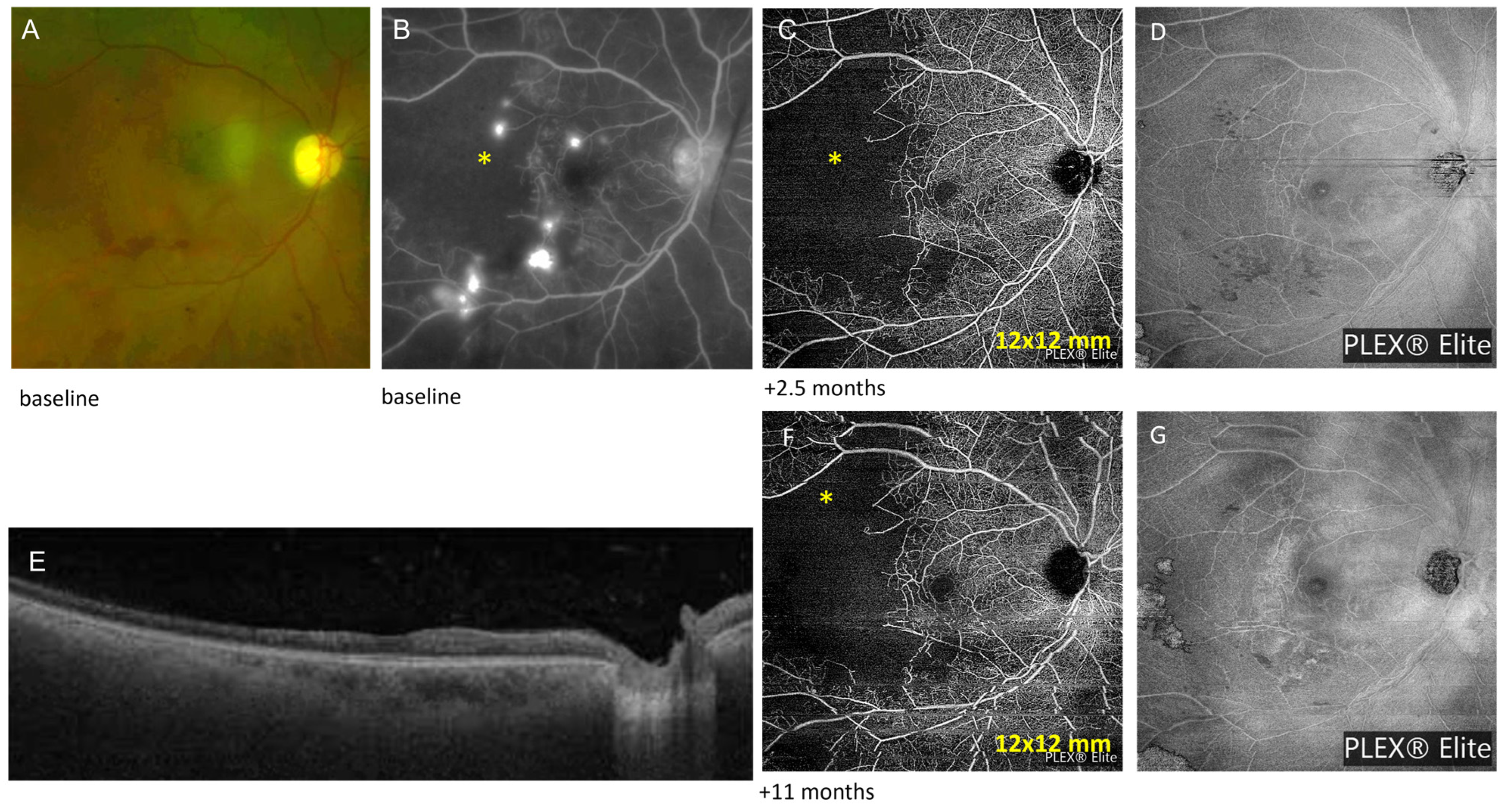 Diagnostics 13 01296 g001