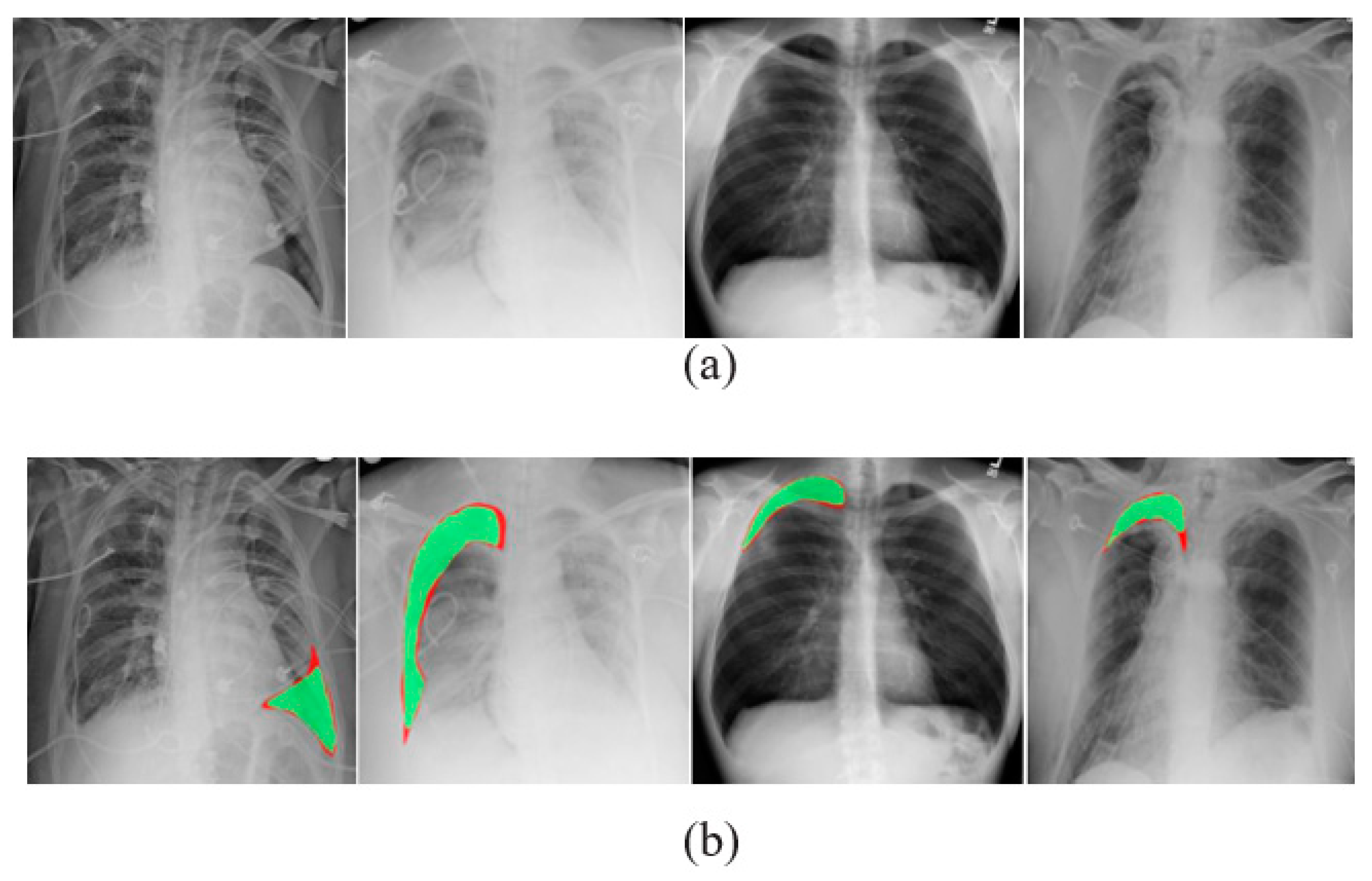 Diagnostics 13 01305 g006