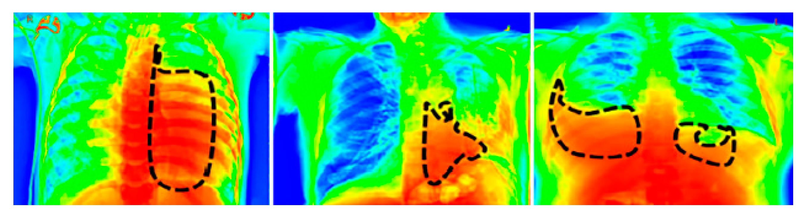 Diagnostics 13 01305 g008