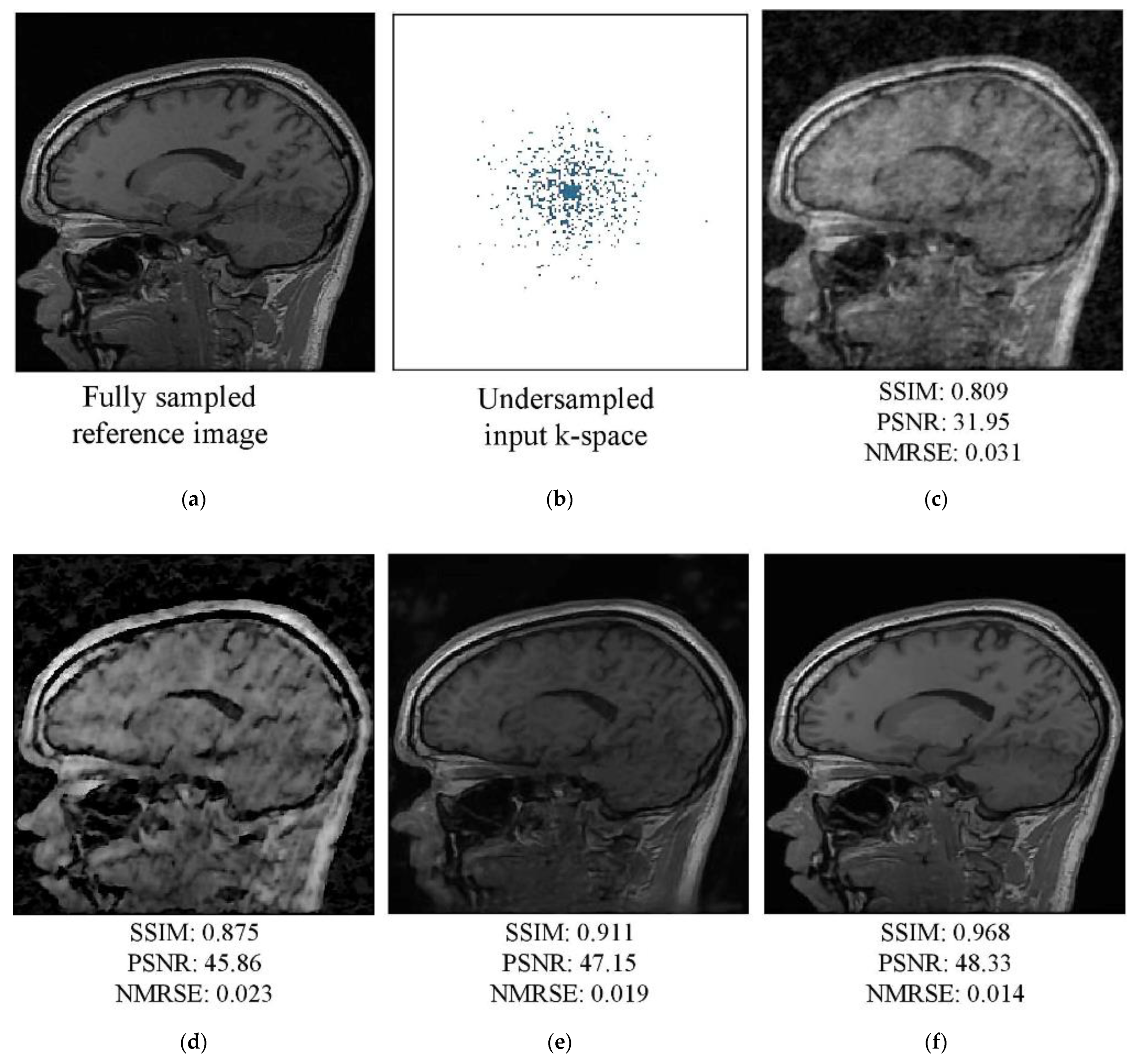 Diagnostics 13 01306 g008 Diagnostics 13 01306 g008
