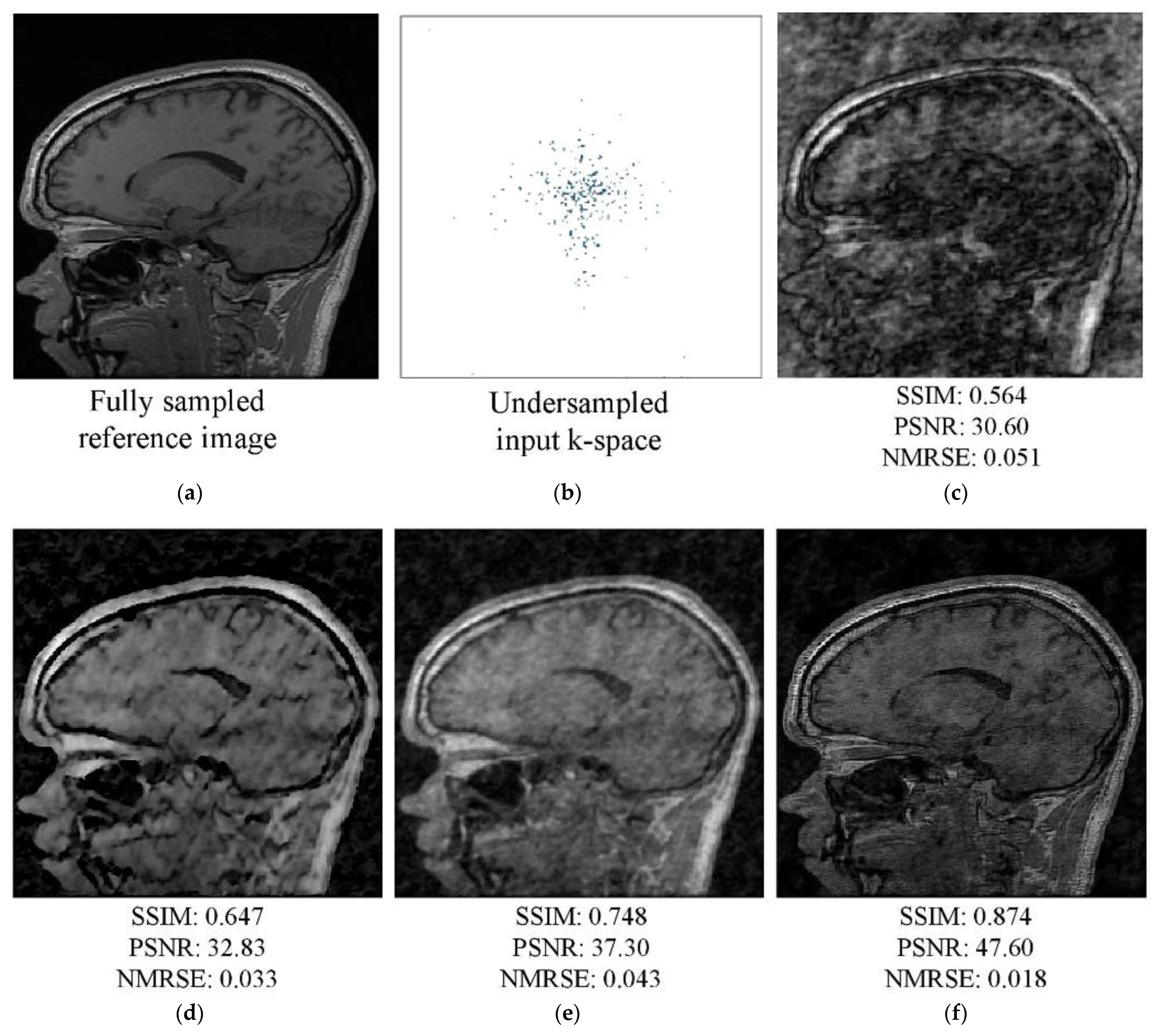 Diagnostics 13 01306 g009 Diagnostics 13 01306 g009