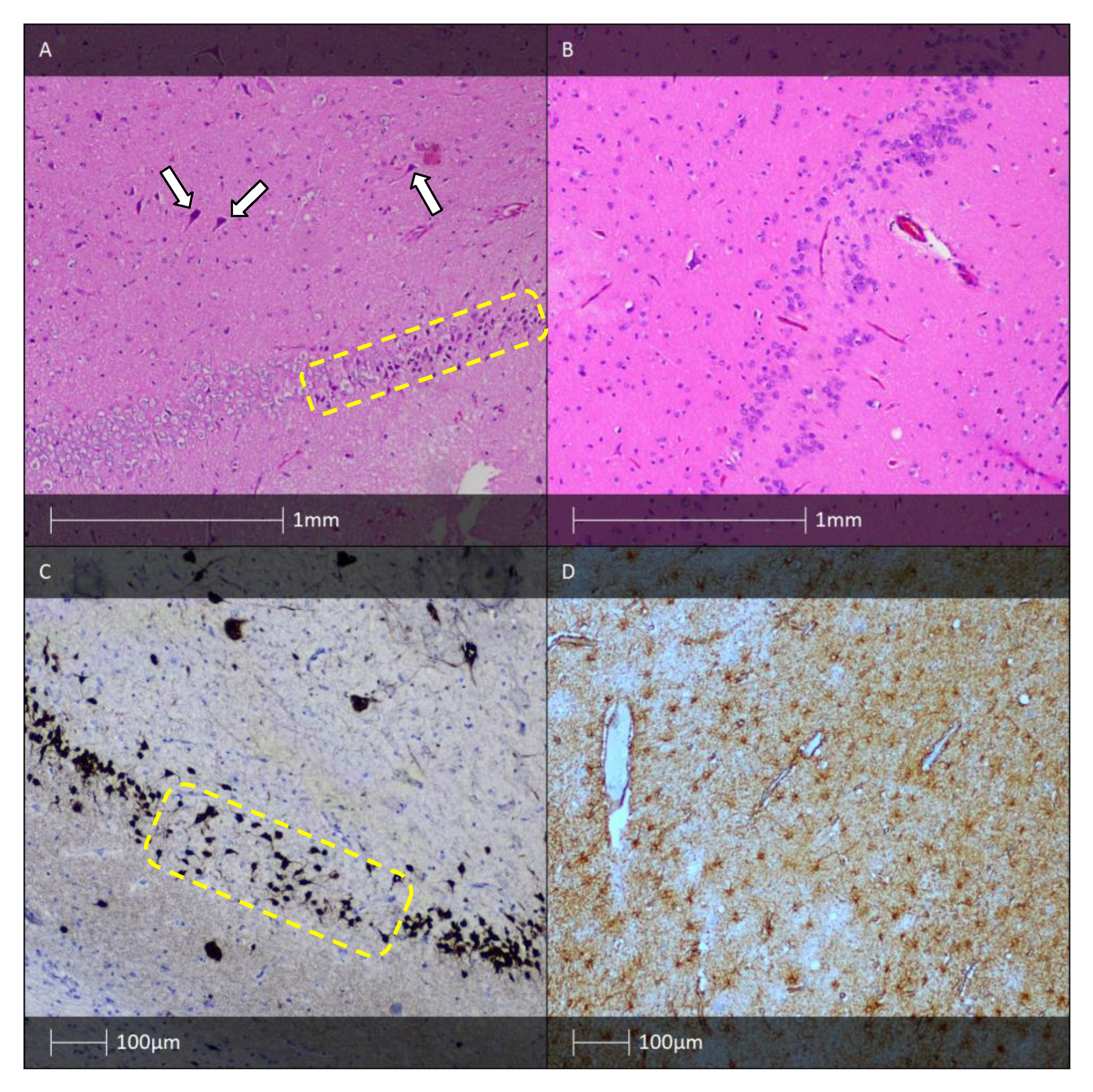 Diagnostics 13 01311 g003