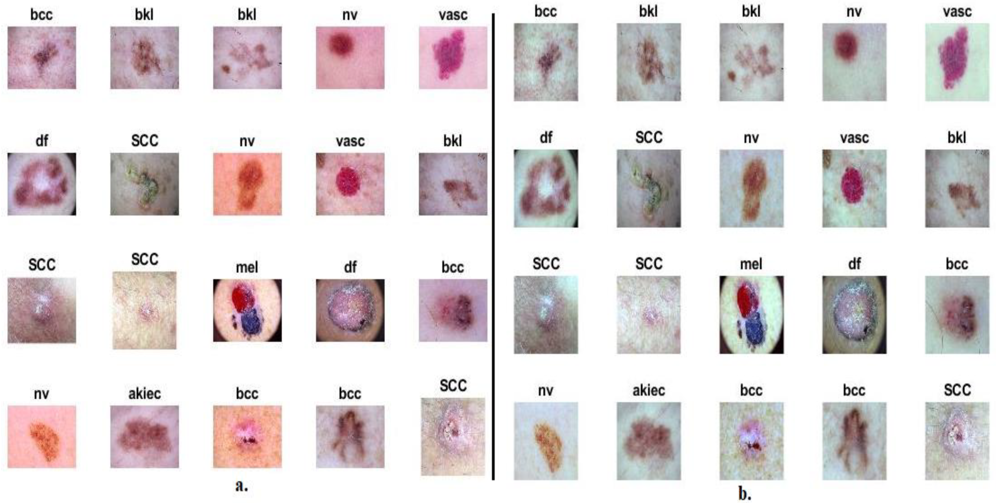 Diagnostics 13 01314 g001