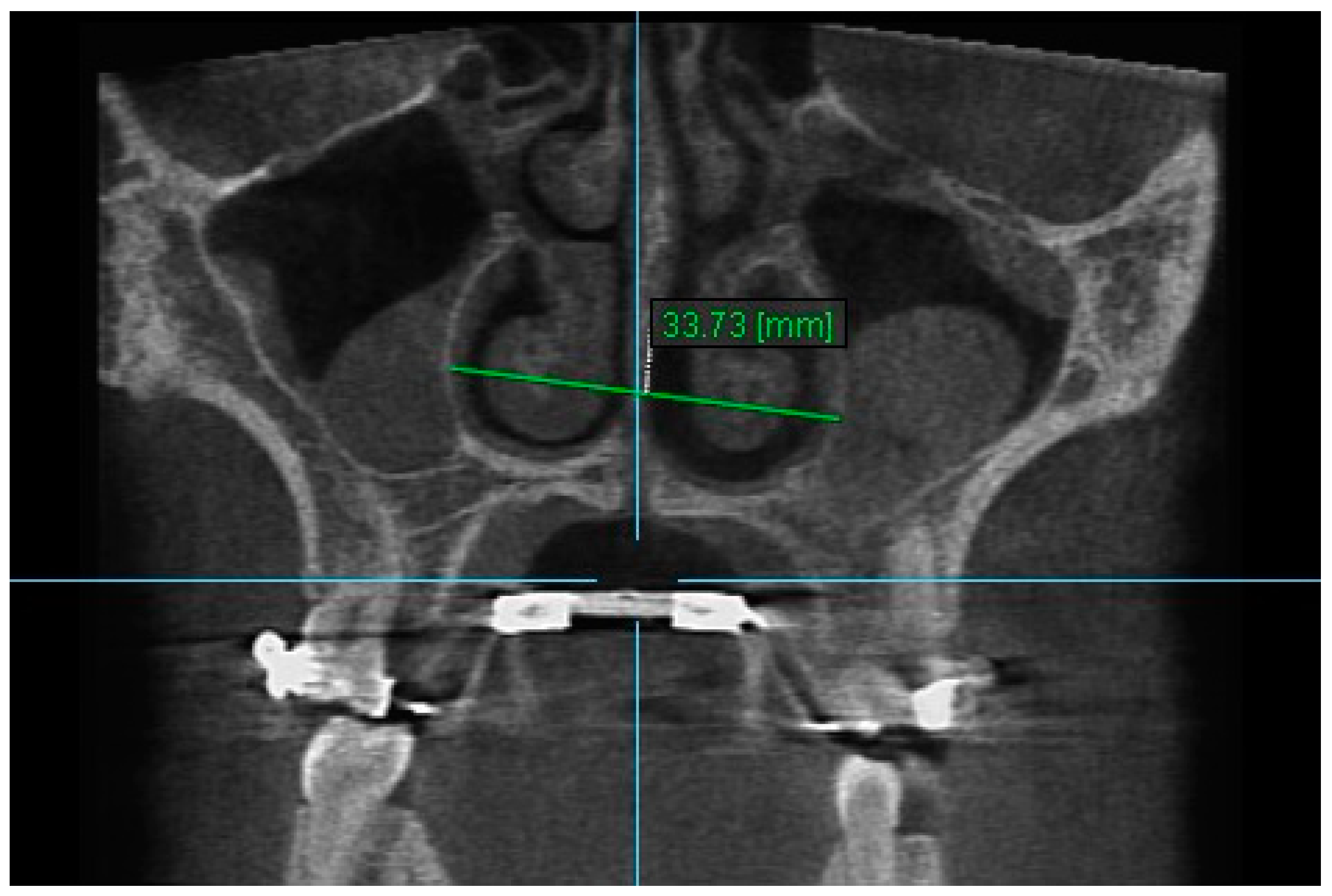 Diagnostics 13 01322 g003