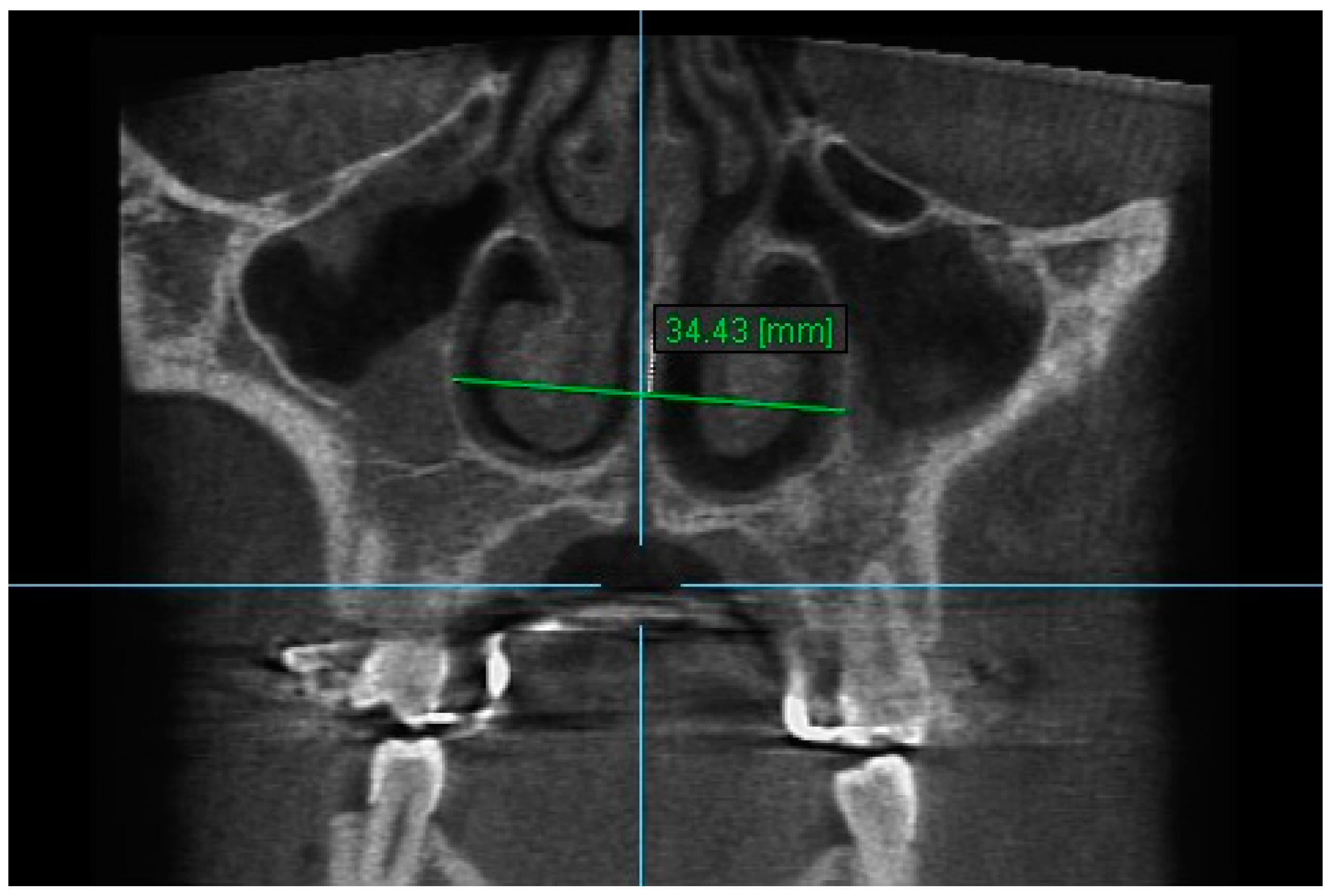 Diagnostics 13 01322 g004