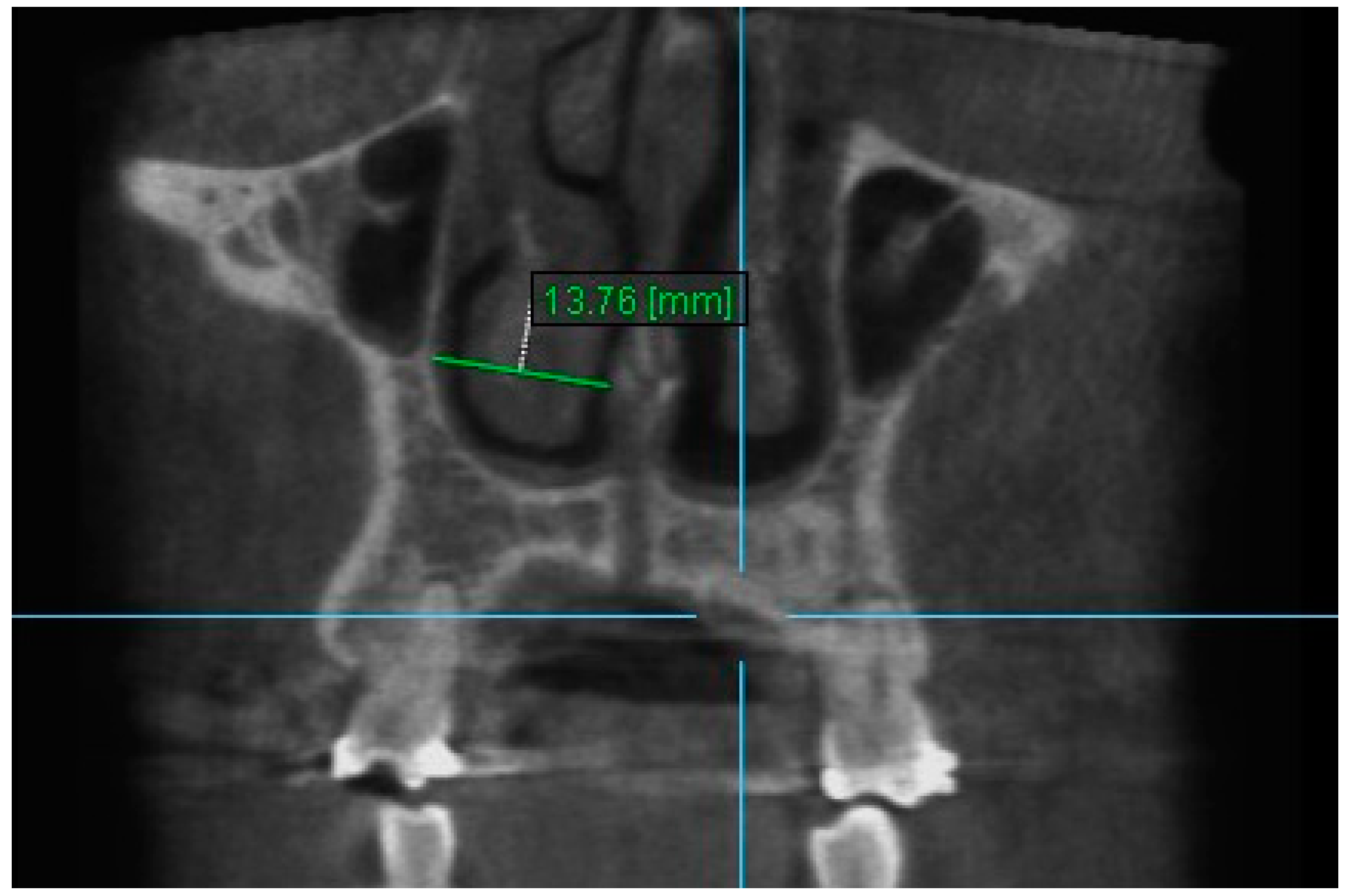 Diagnostics 13 01322 g006