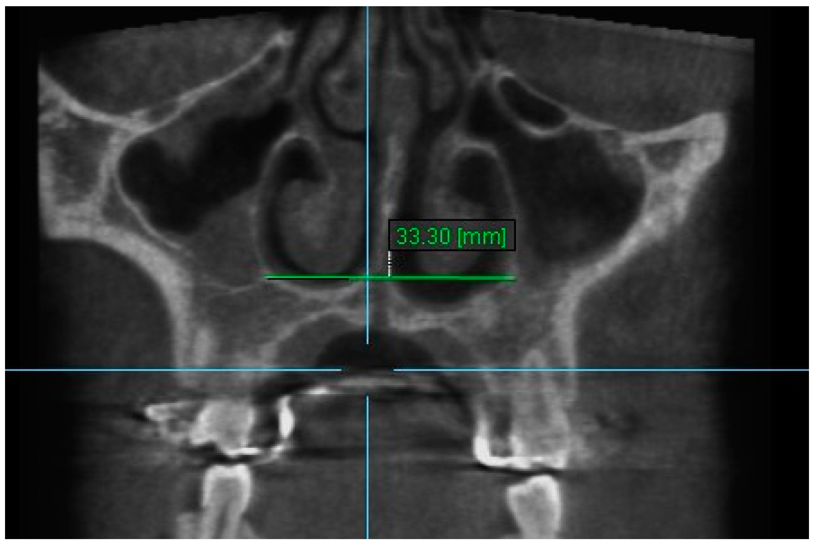 Diagnostics 13 01322 g010