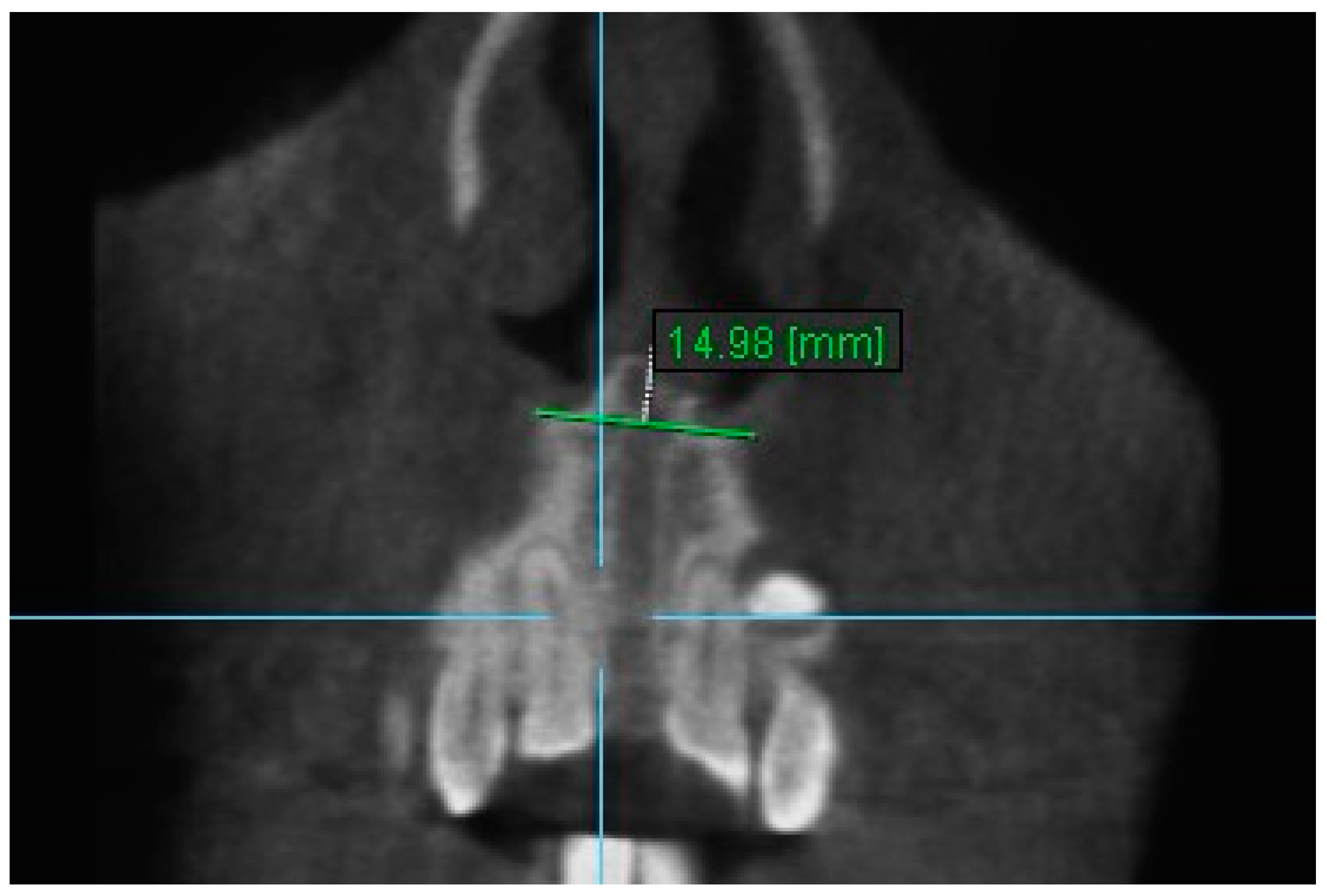 Diagnostics 13 01322 g011