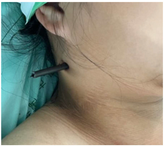 Diagnostics 13 01323 g001