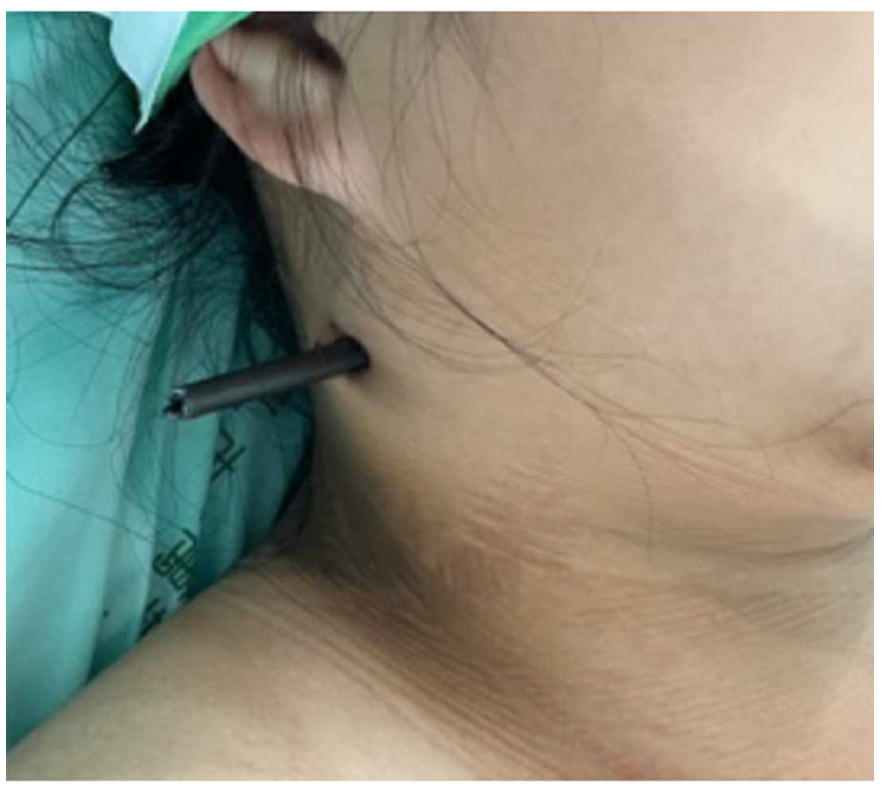 Diagnostics 13 01323 g001