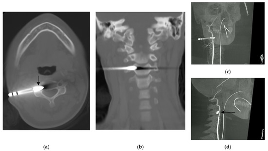 Diagnostics 13 01323 g002
