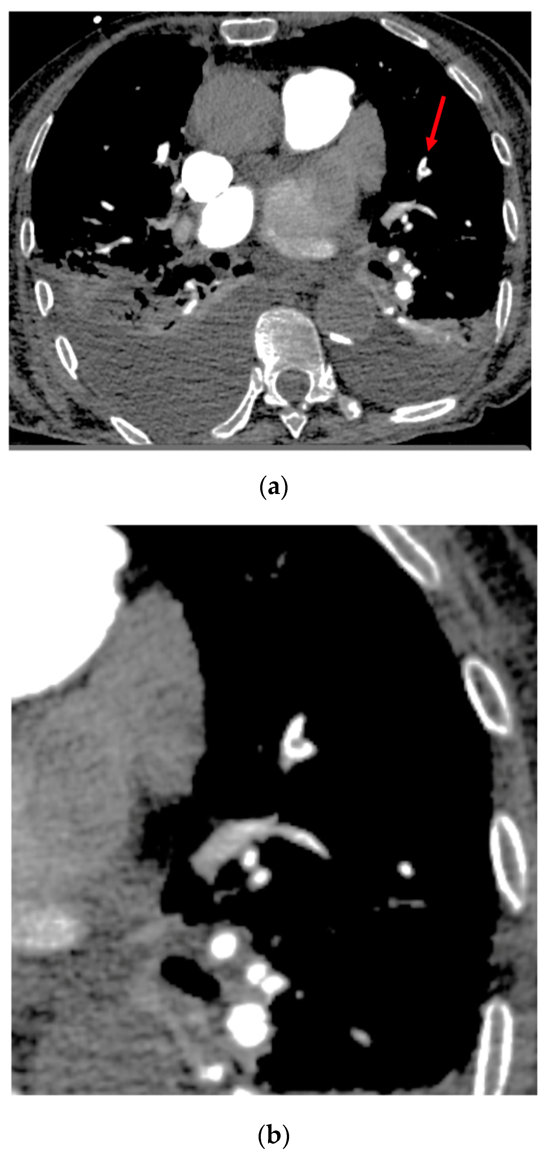 Diagnostics 13 01324 g003