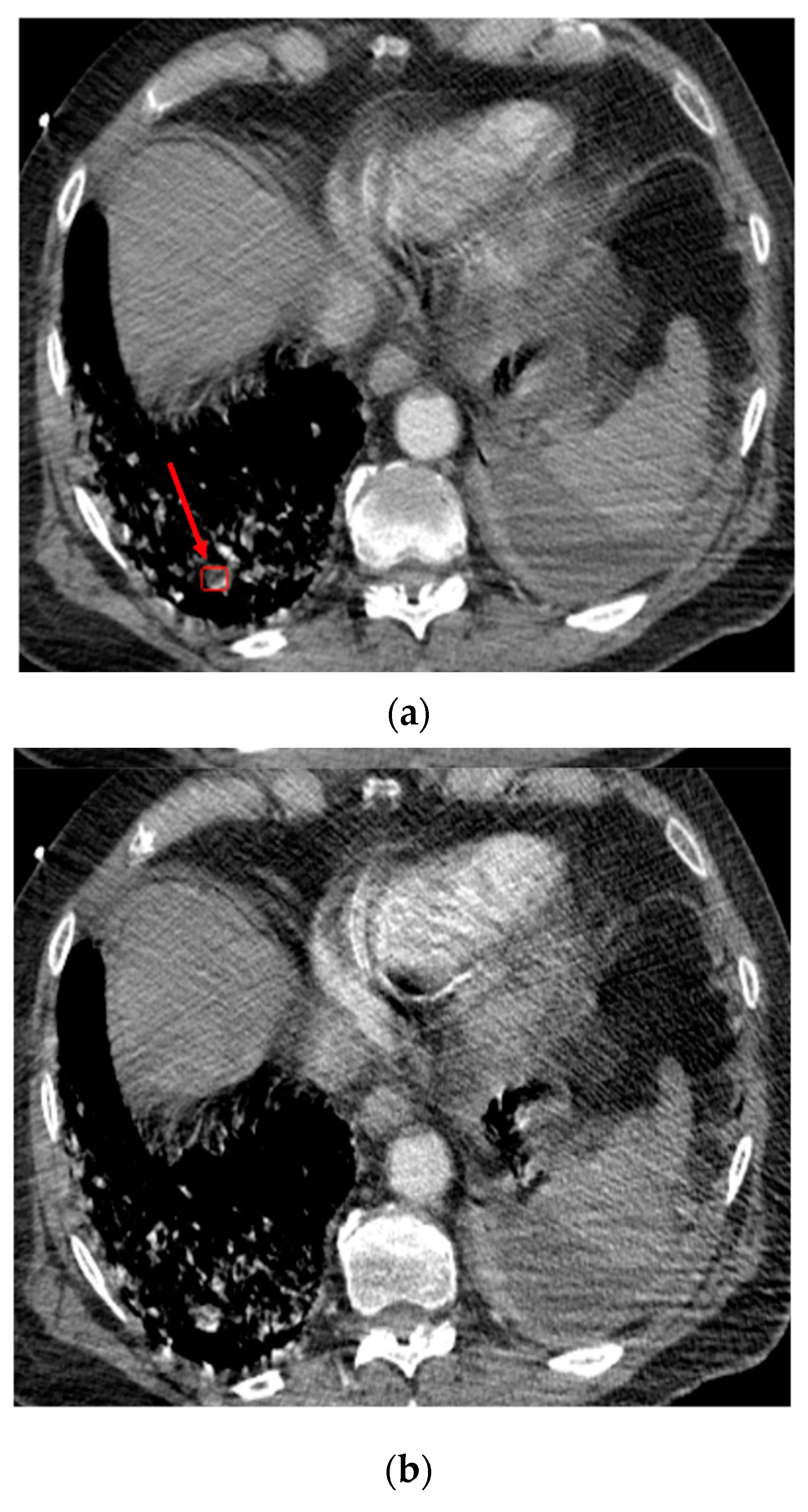 Diagnostics 13 01324 g004