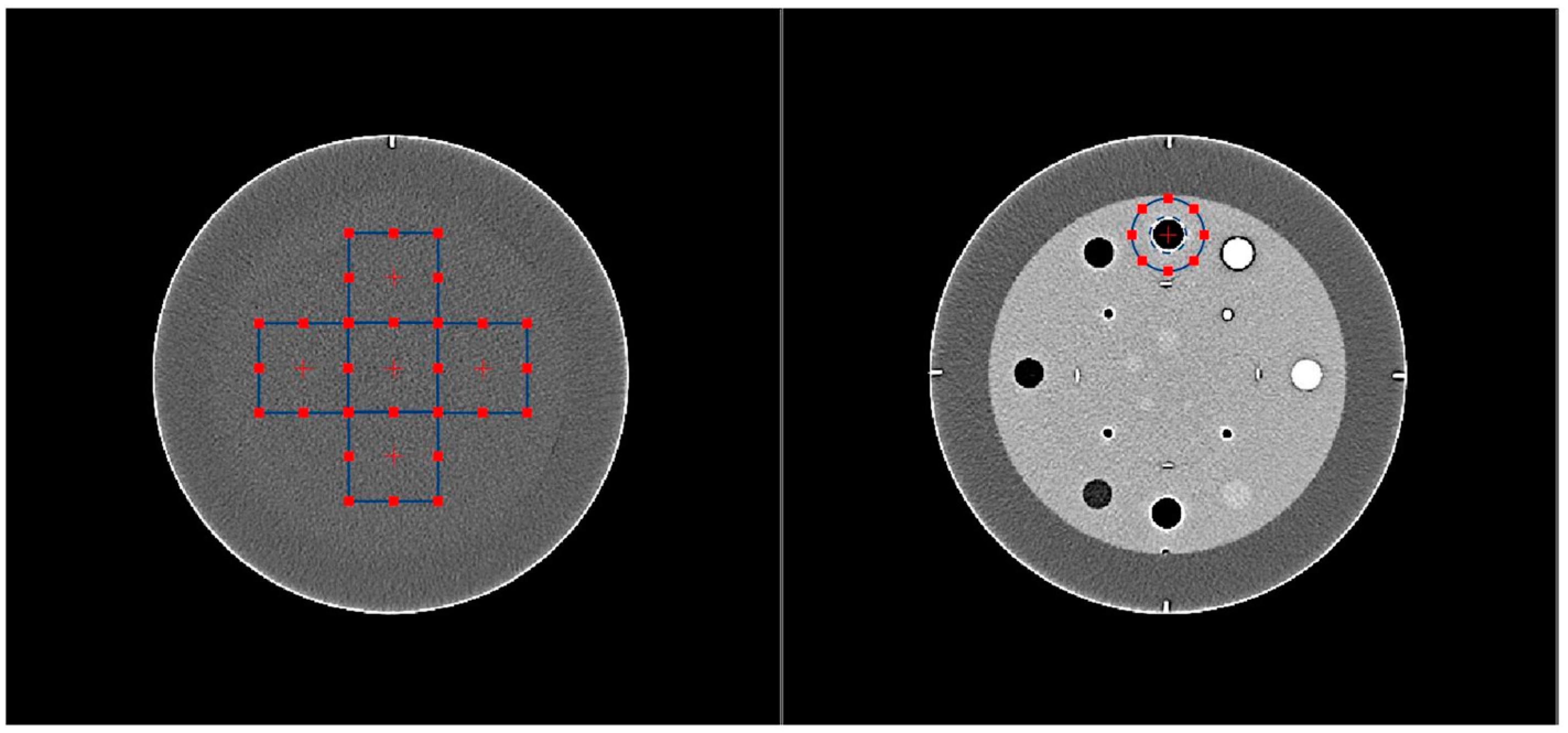 Diagnostics 13 01325 g001