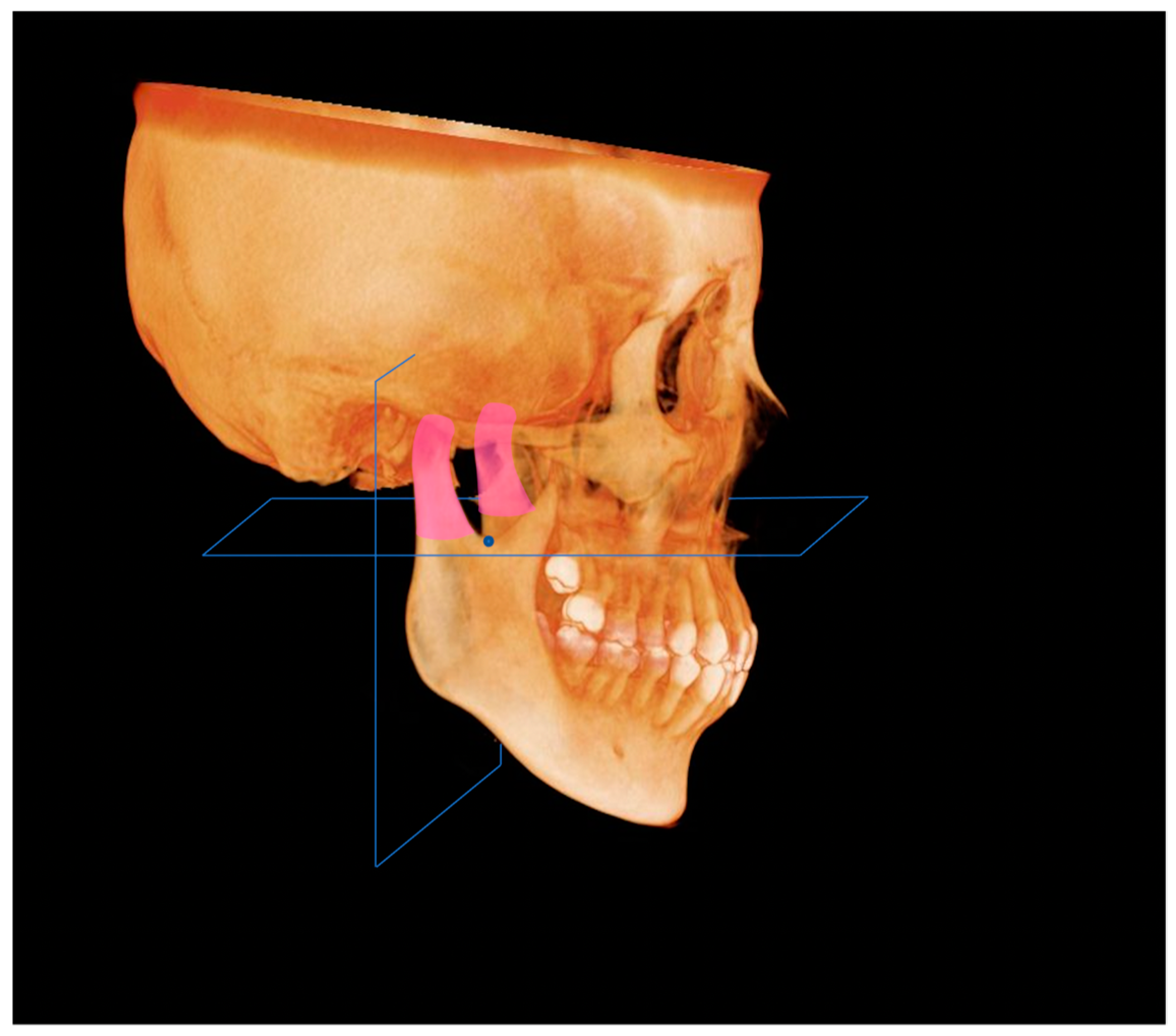 Diagnostics 13 01331 g005