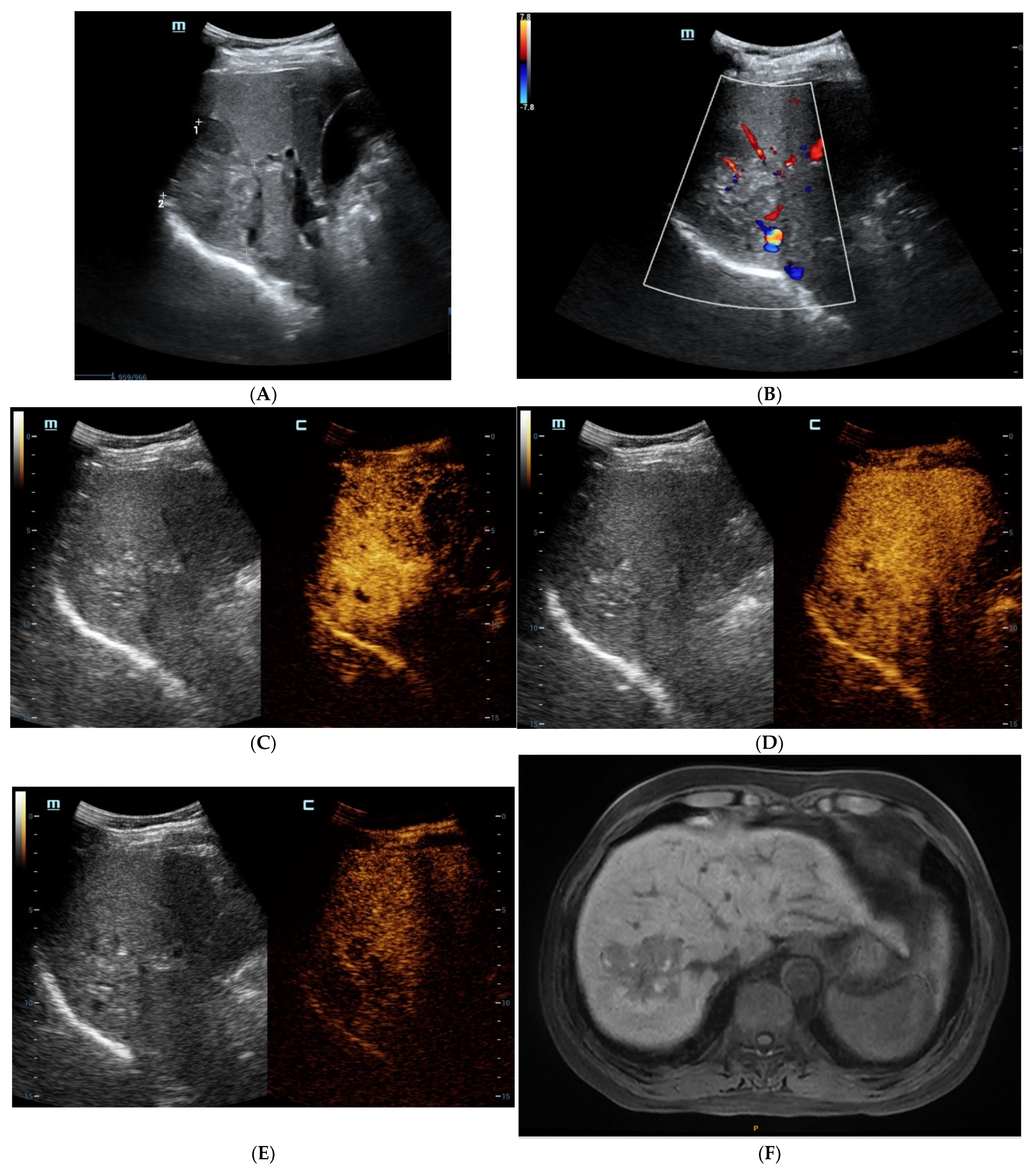 Diagnostics 13 01337 g001a