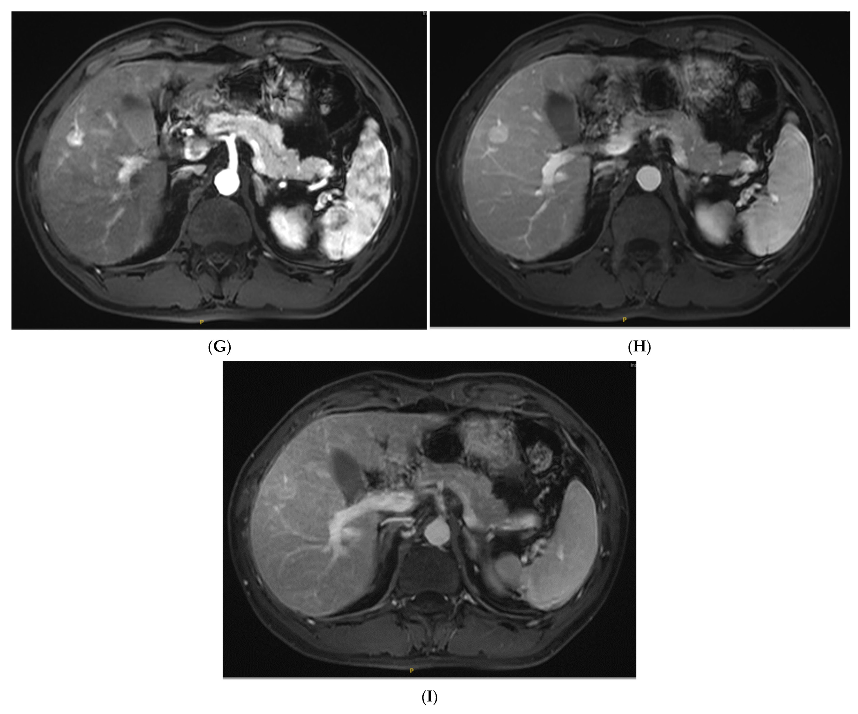 Diagnostics 13 01337 g002b