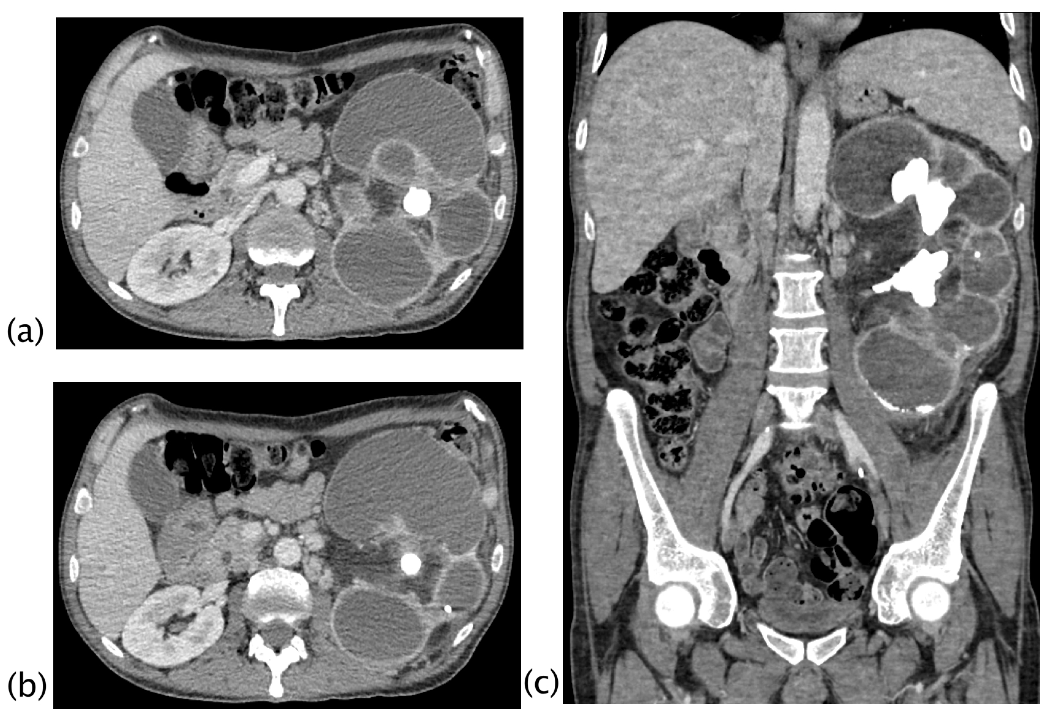 Diagnostics 13 01340 g003