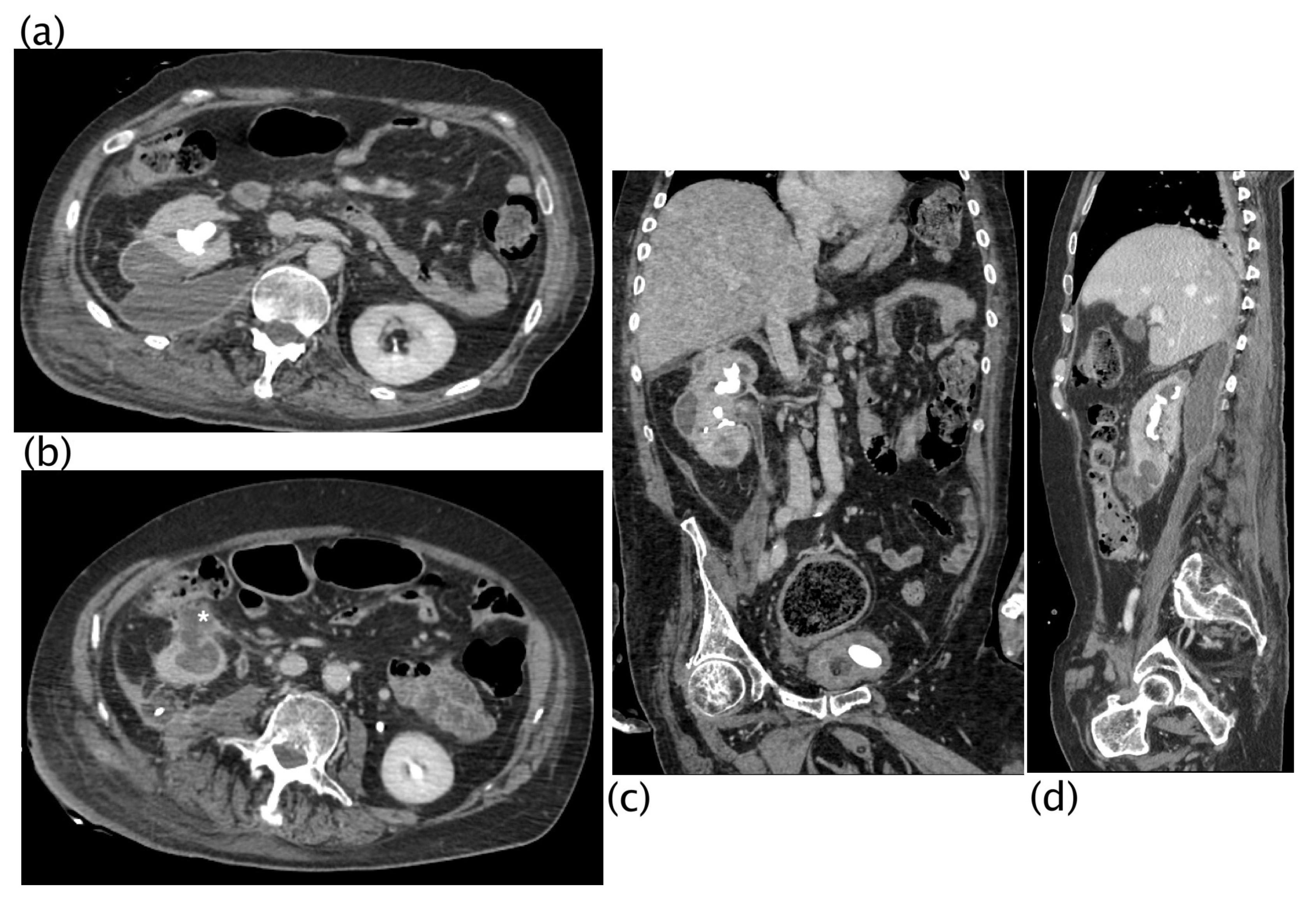 Diagnostics 13 01340 g005