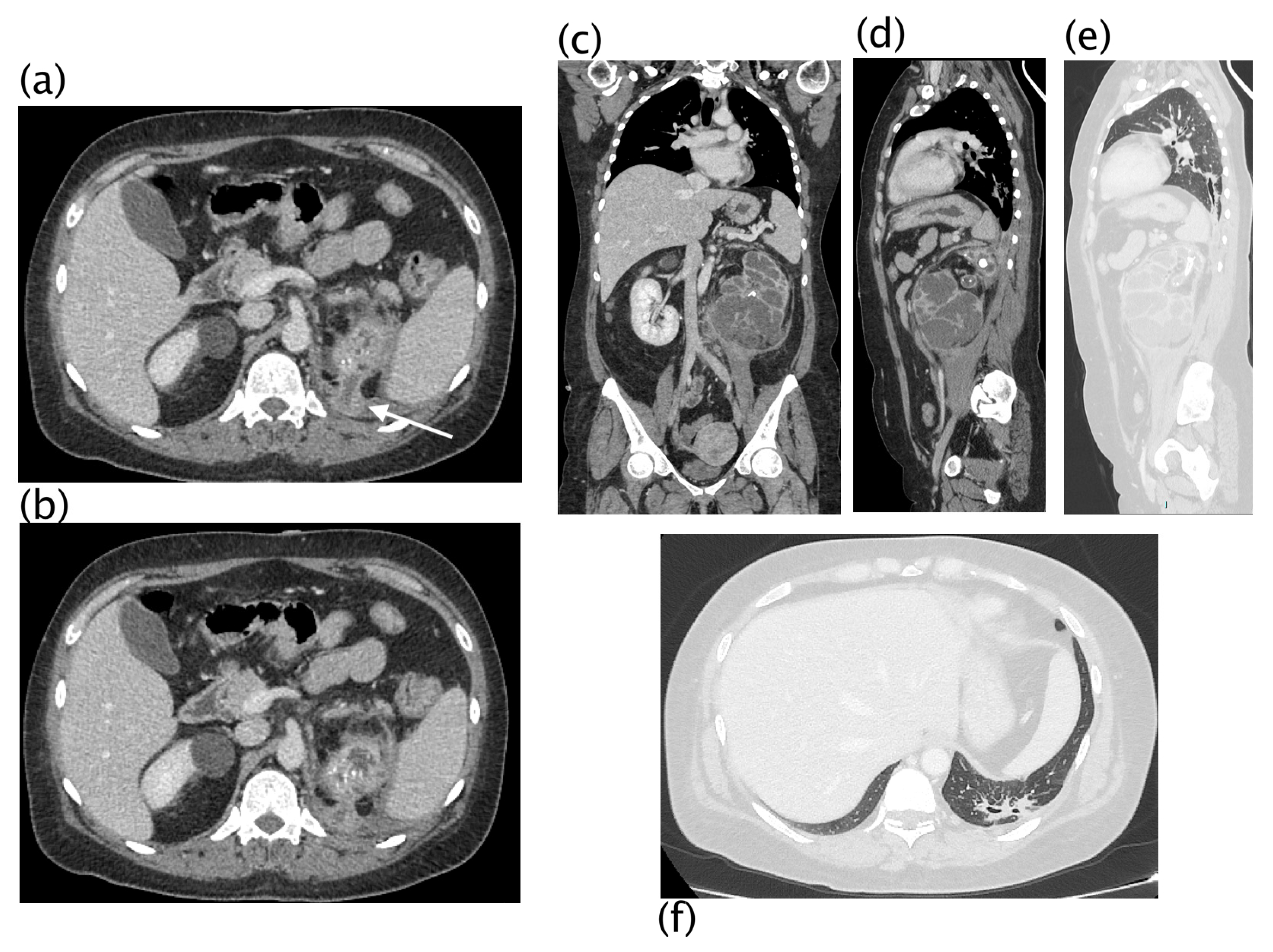 Diagnostics 13 01340 g006