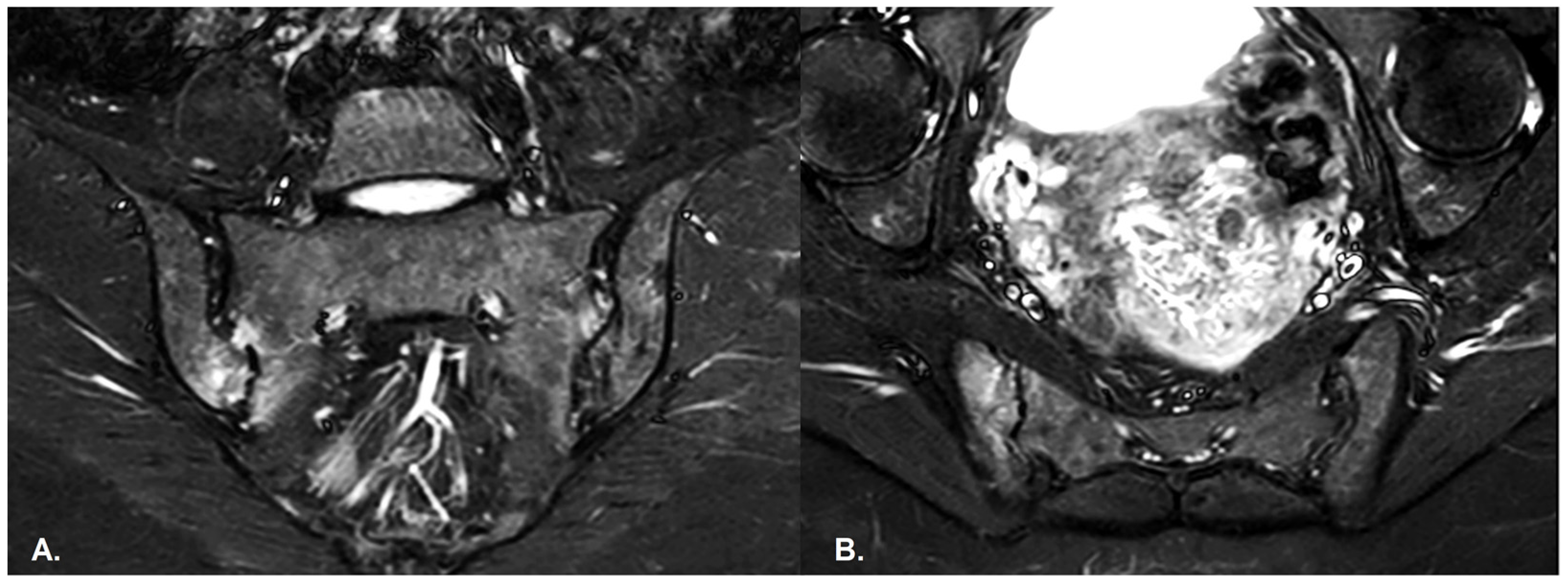 Diagnostics 13 01342 g004