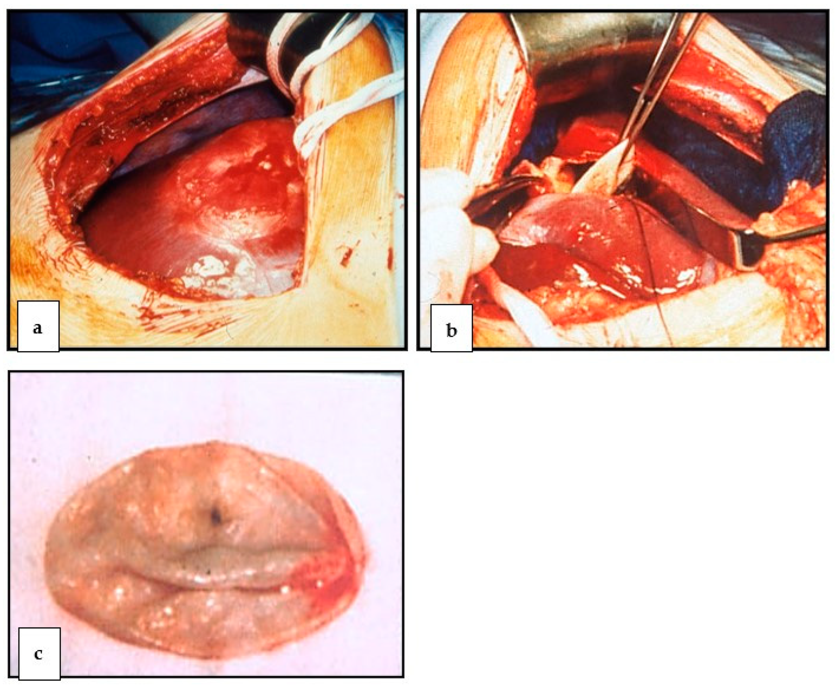 Diagnostics 13 01343 g005