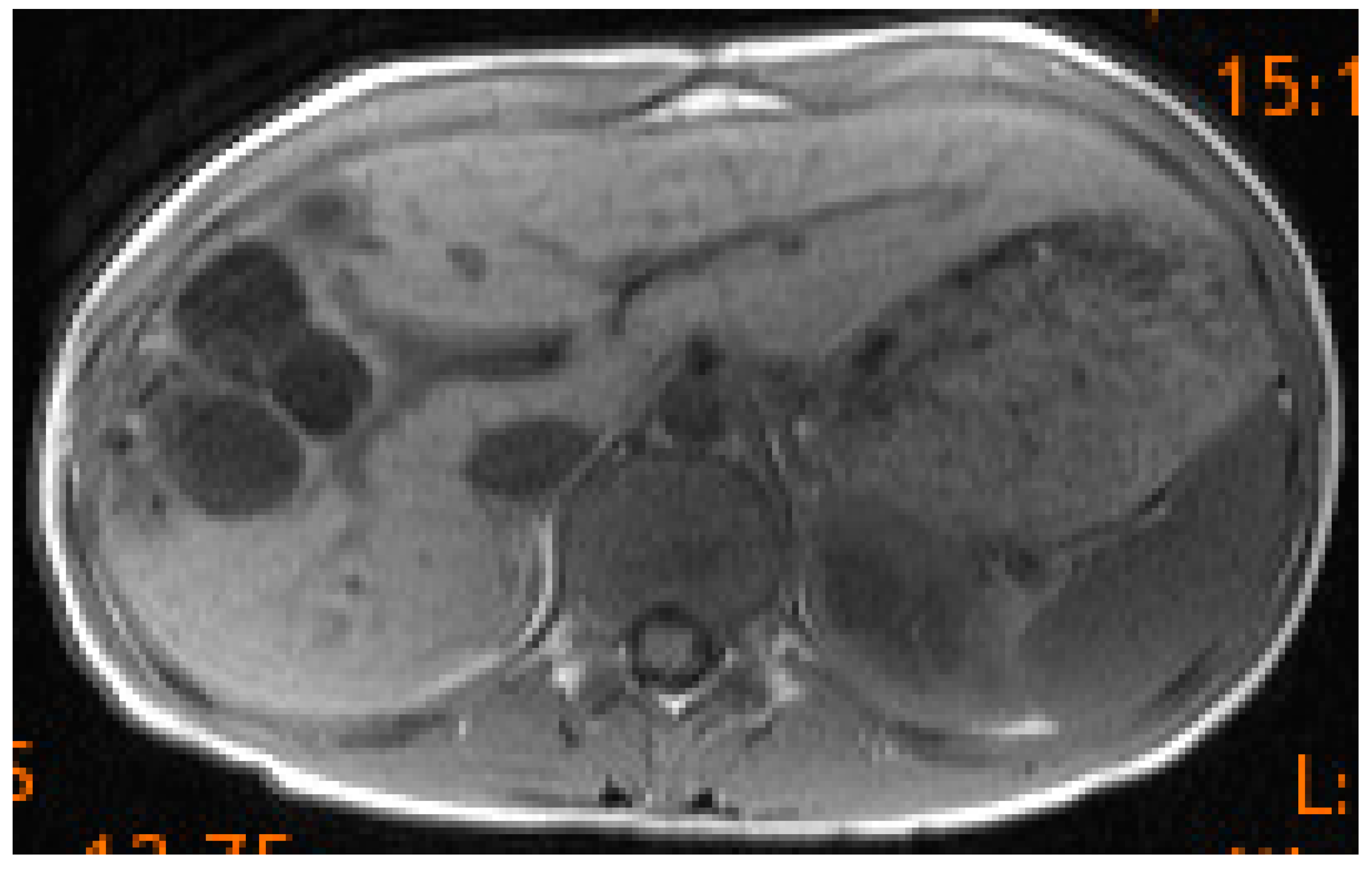 Diagnostics 13 01343 g006