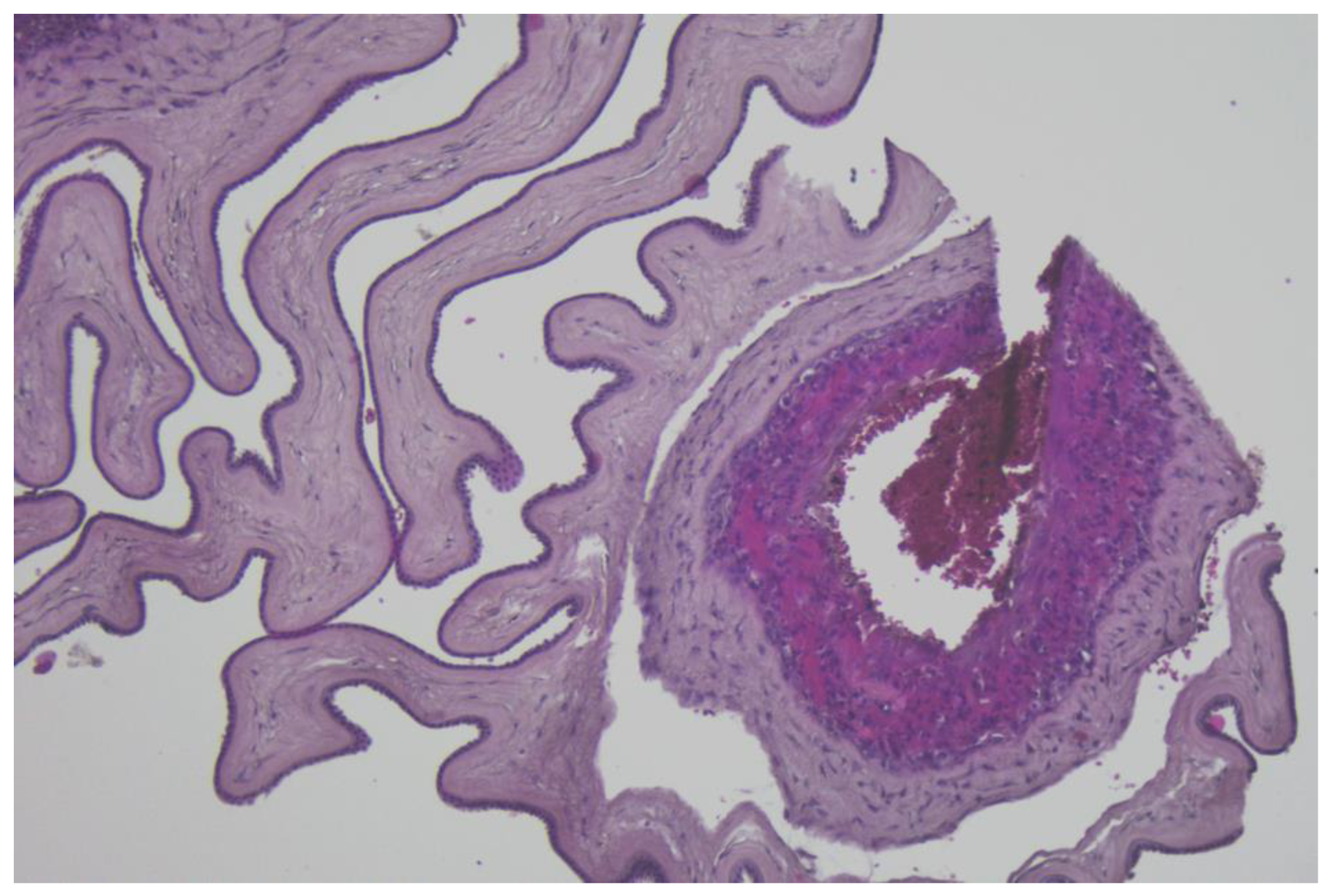 Diagnostics 13 01345 g003 Diagnostics 13 01345 g003