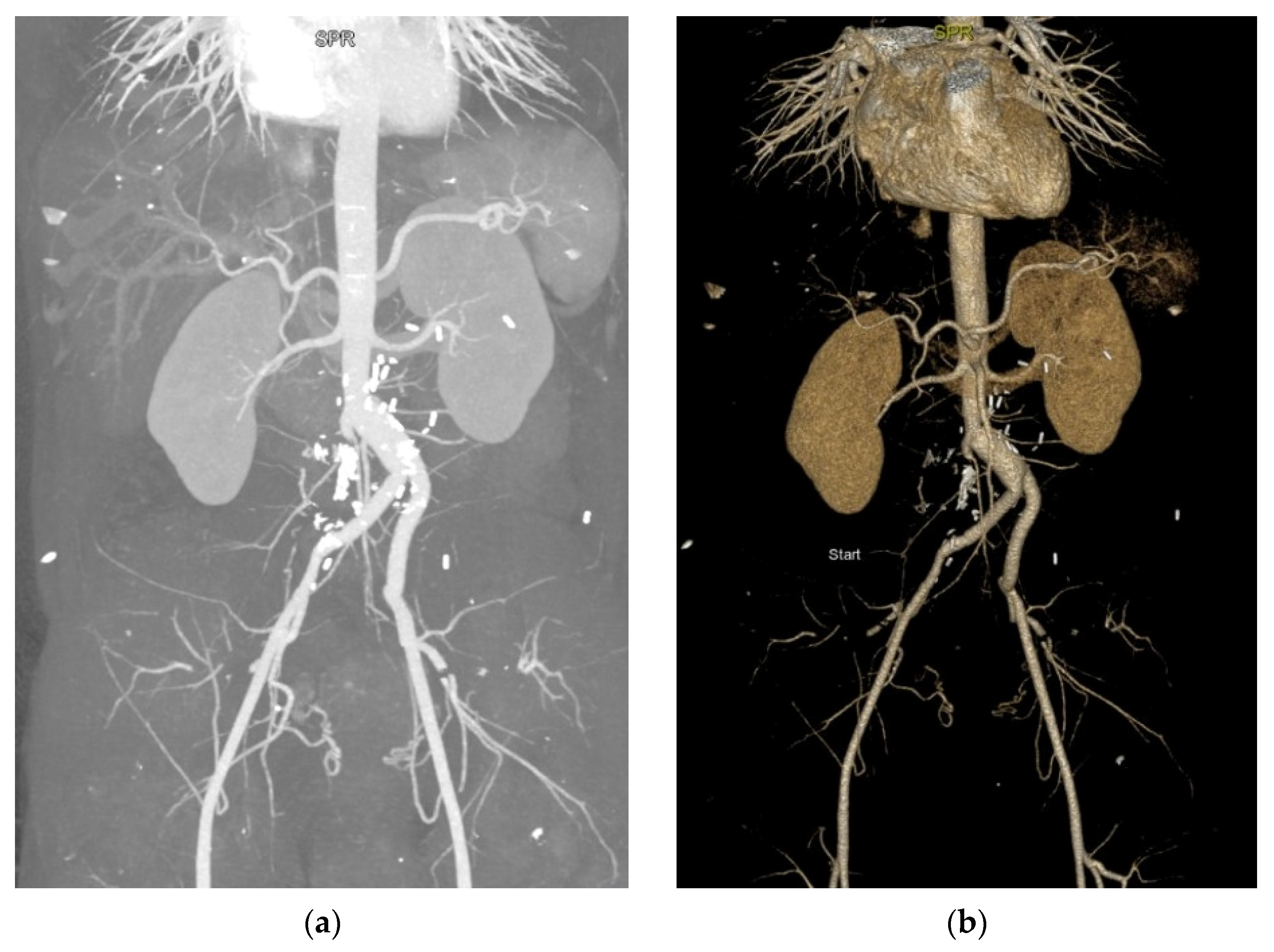 Diagnostics 13 01346 g002