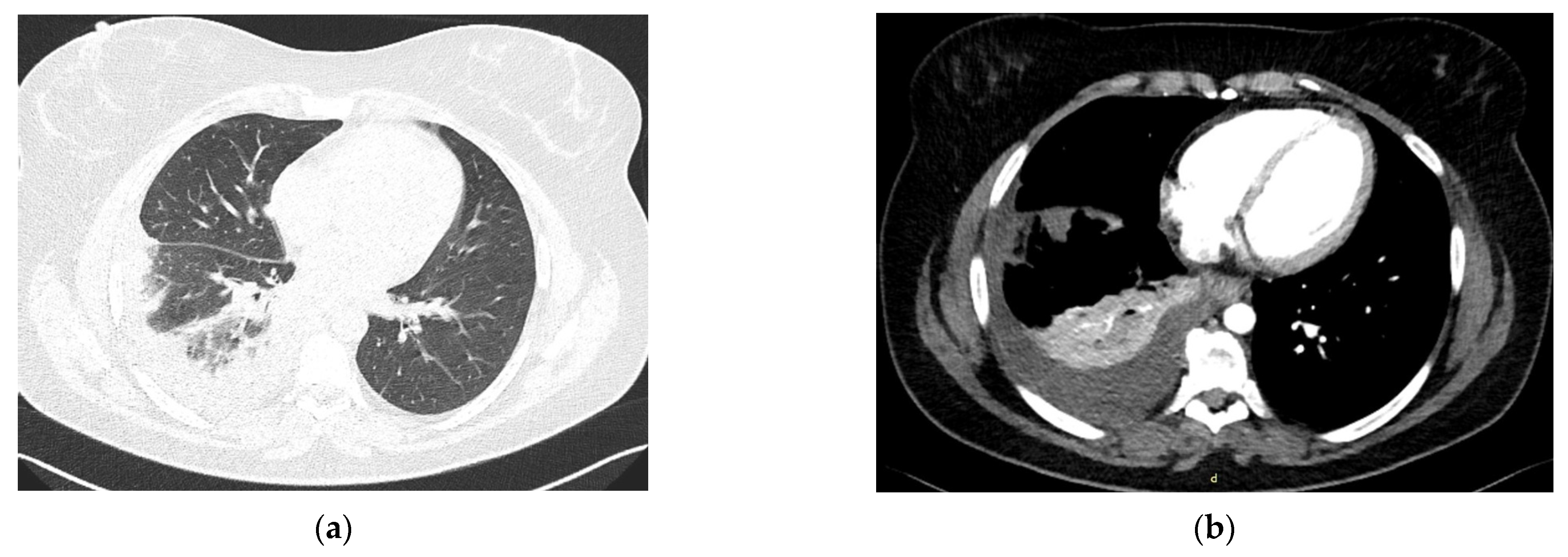 Diagnostics 13 01346 g003