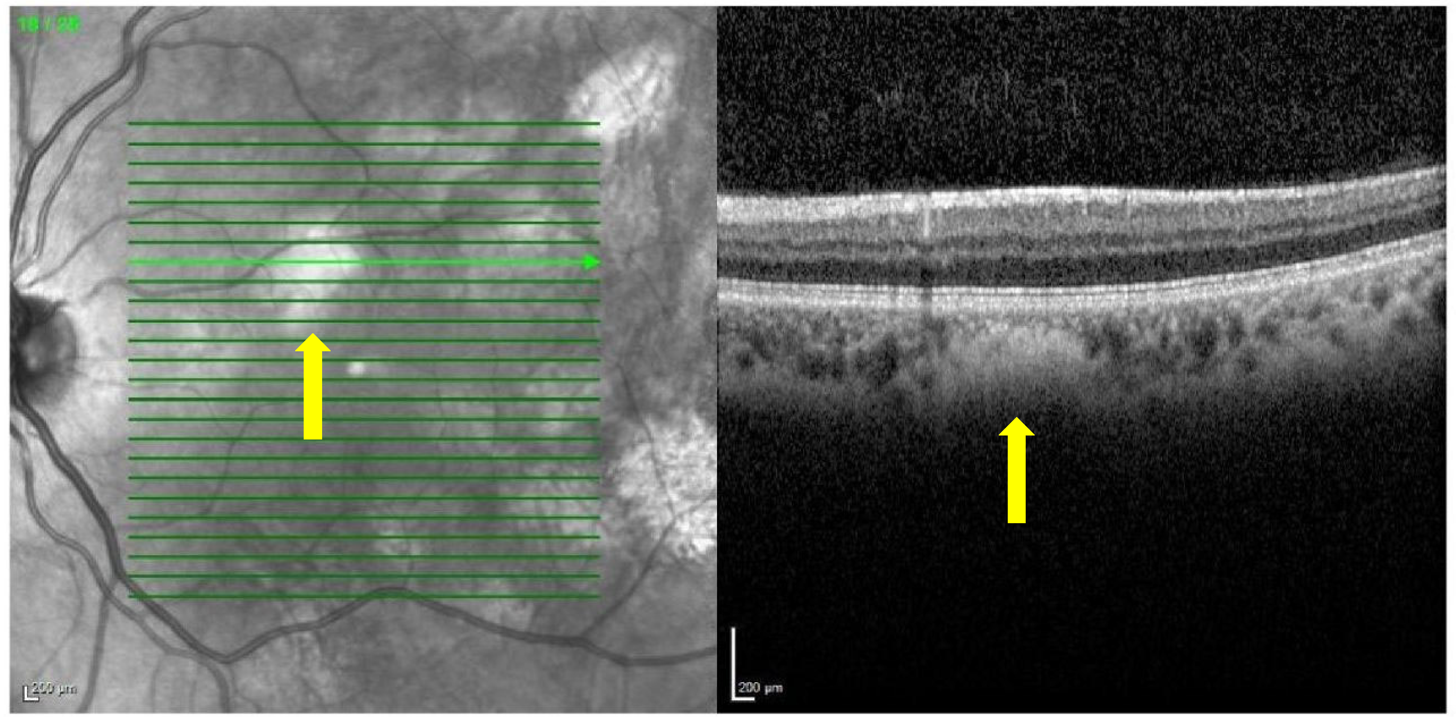 Diagnostics 13 01348 g001