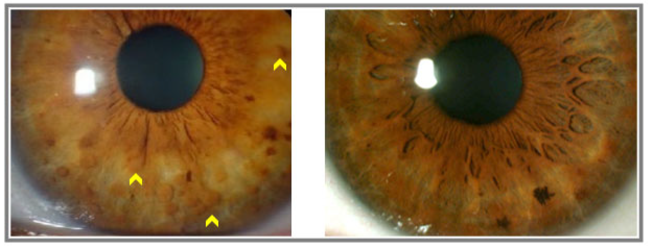 Diagnostics 13 01348 g002